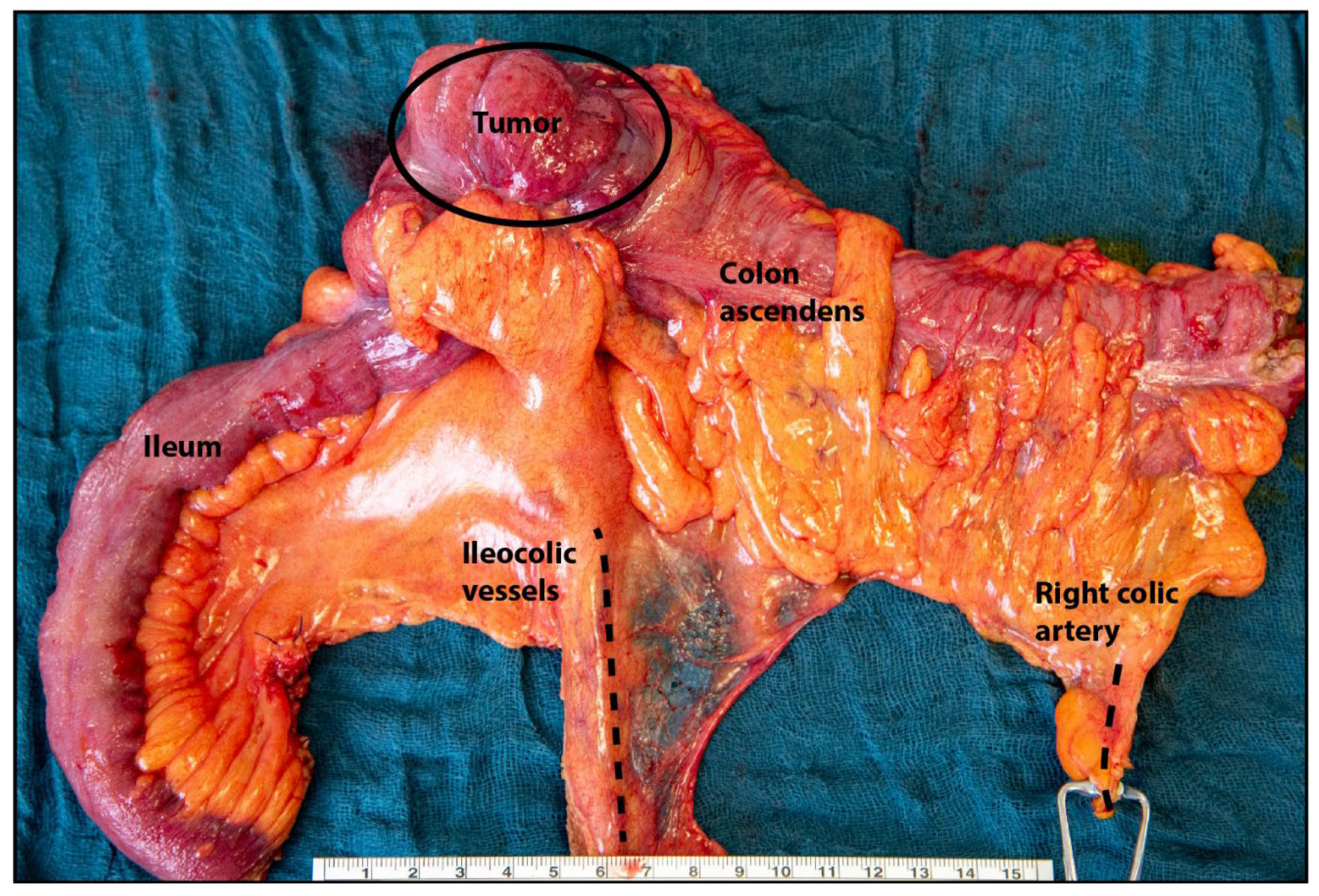 Cancers 16 00890 g001 Cancers 16 00890 g001