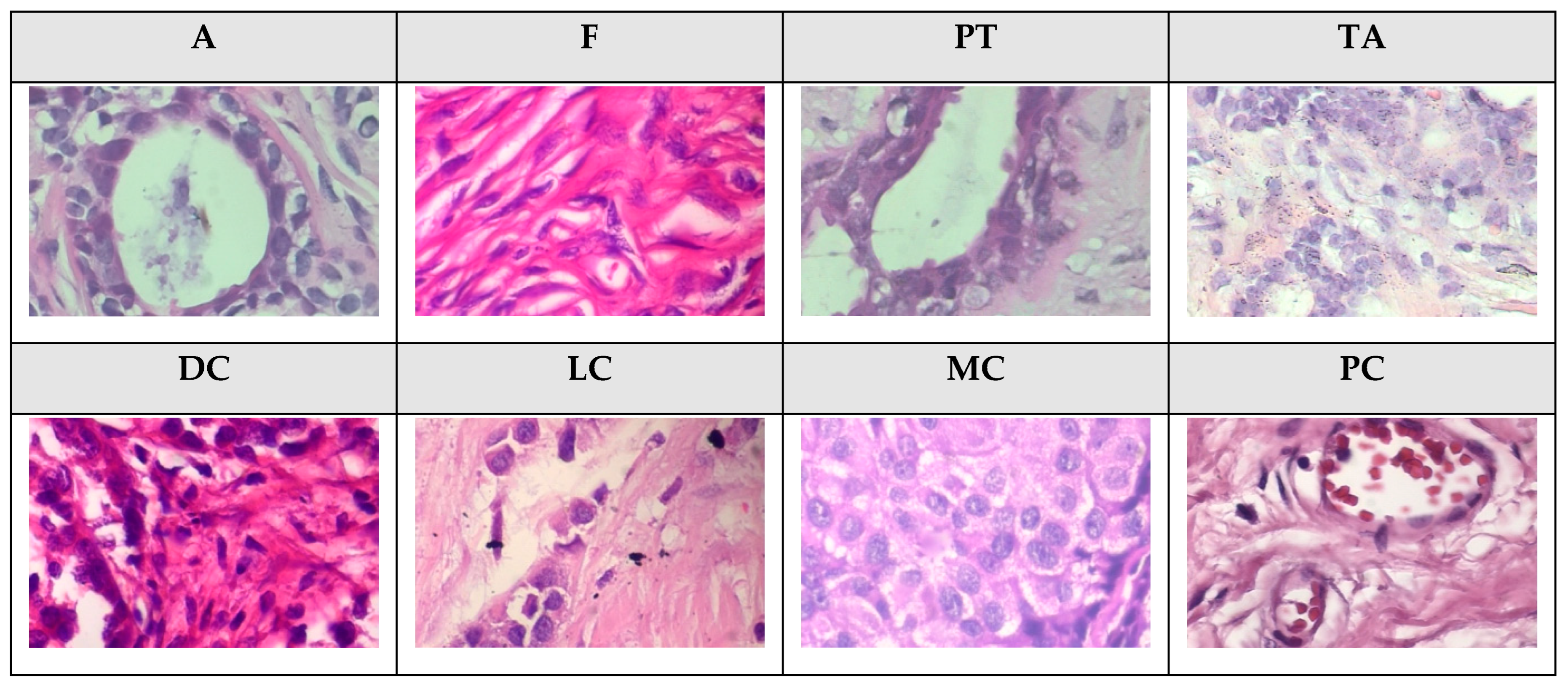 Cancers 16 01362 g004 Cancers 16 01362 g004