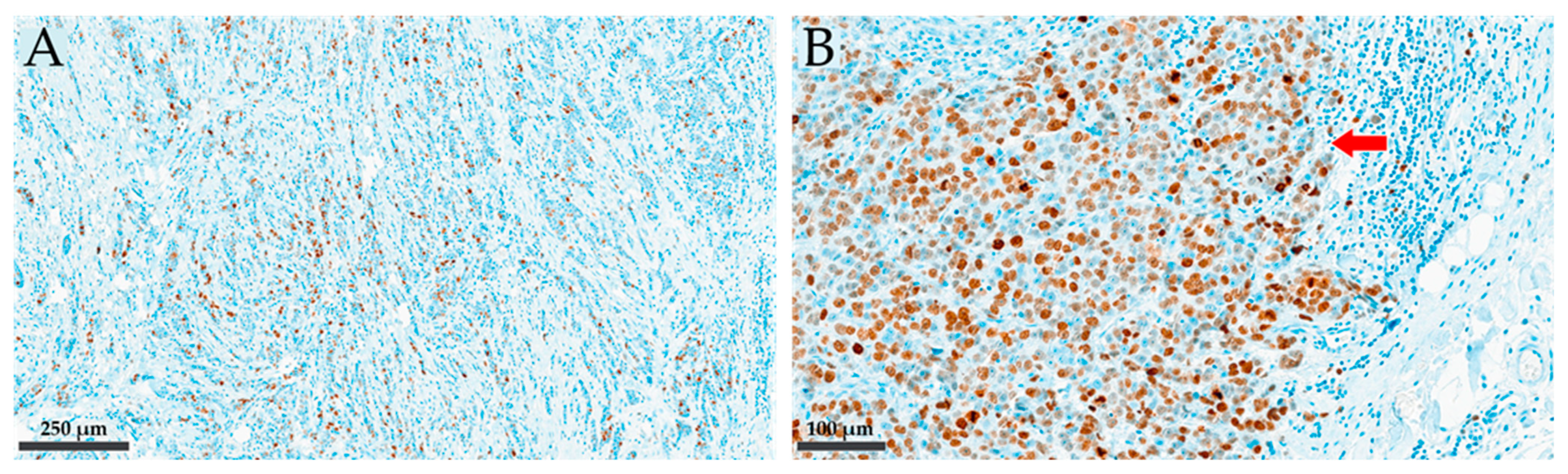 Cancers 16 01405 g001 Cancers 16 01405 g001
