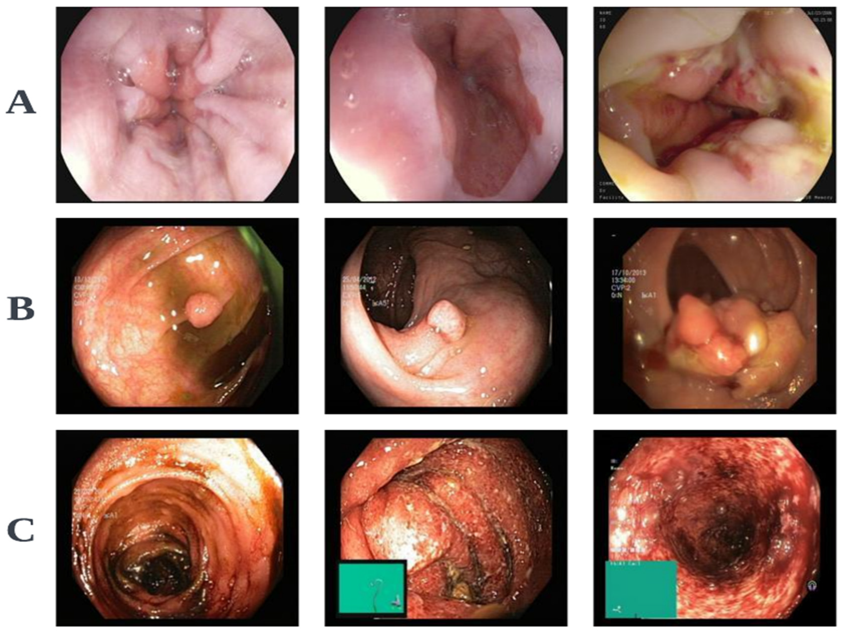 Cancers 16 01441 g004