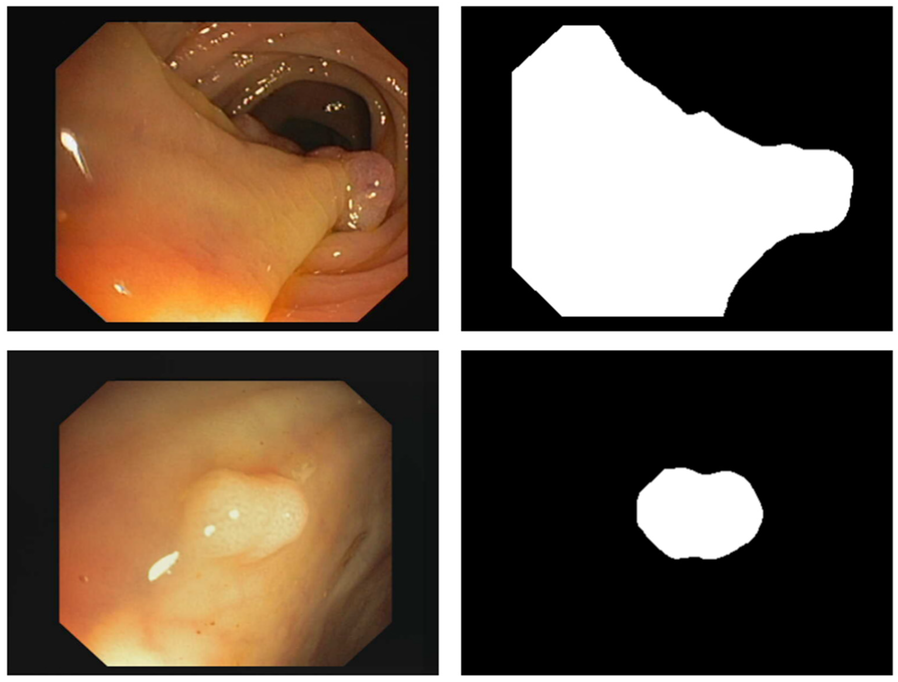 Cancers 16 01441 g007