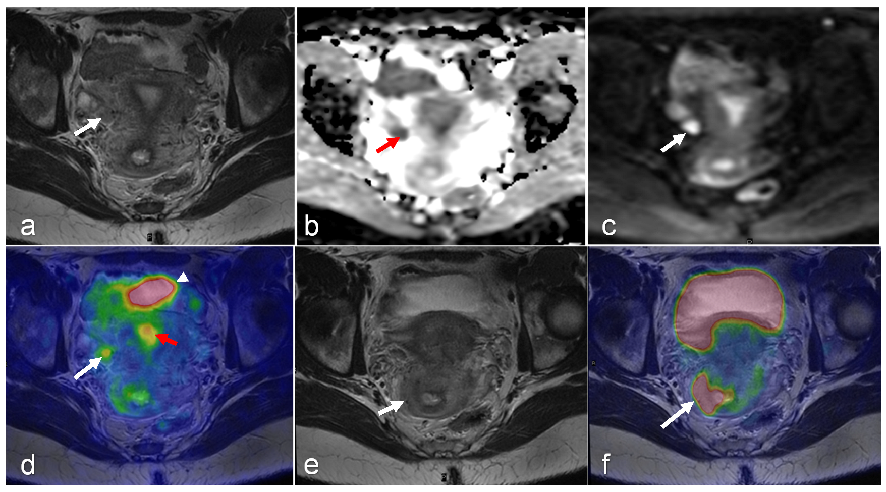 Cancers 16 01478 g003