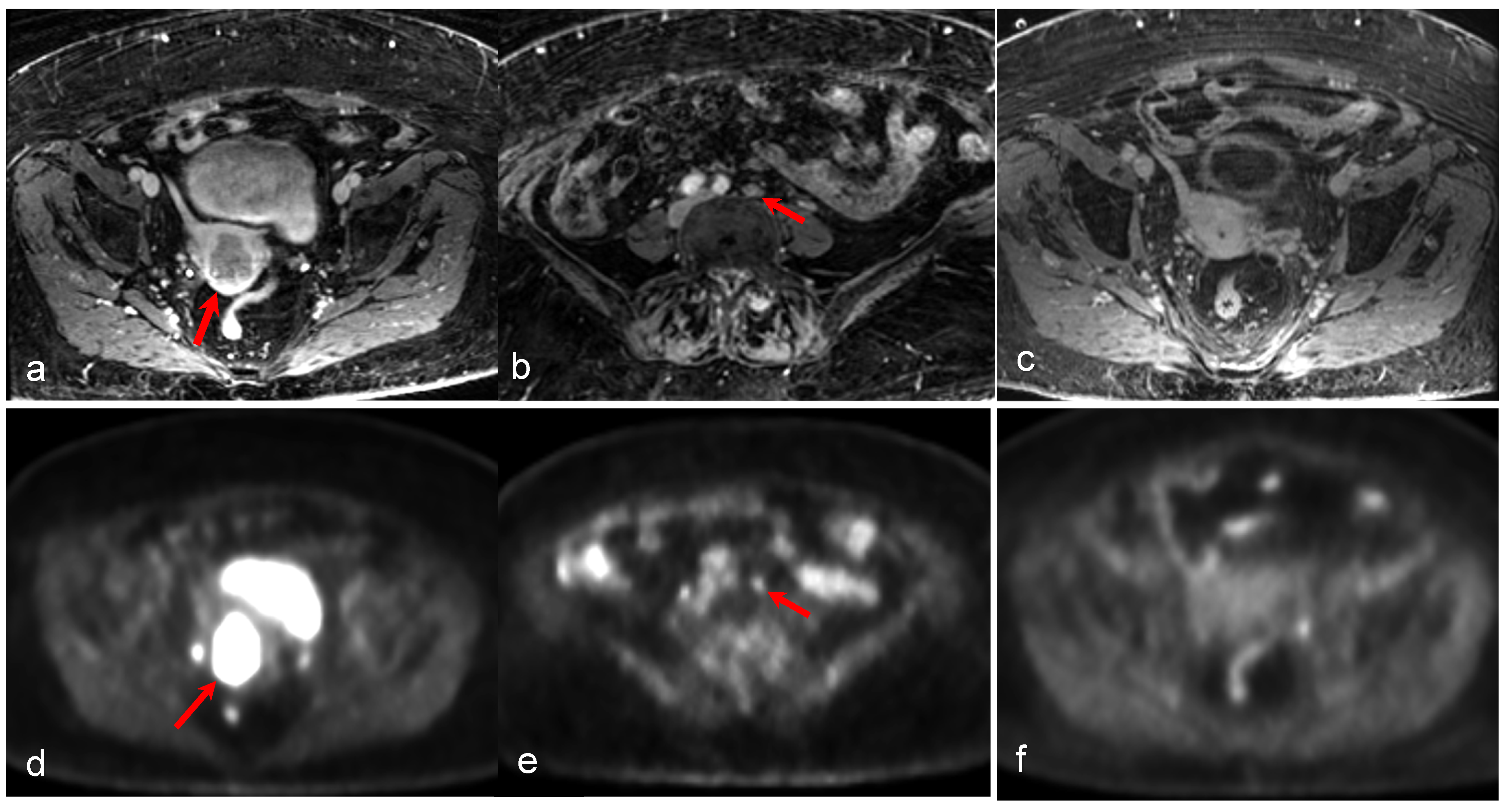 Cancers 16 01478 g005
