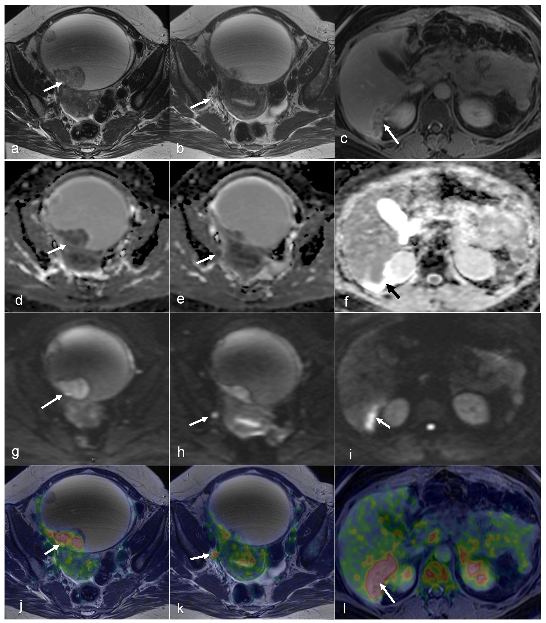 Cancers 16 01478 g007