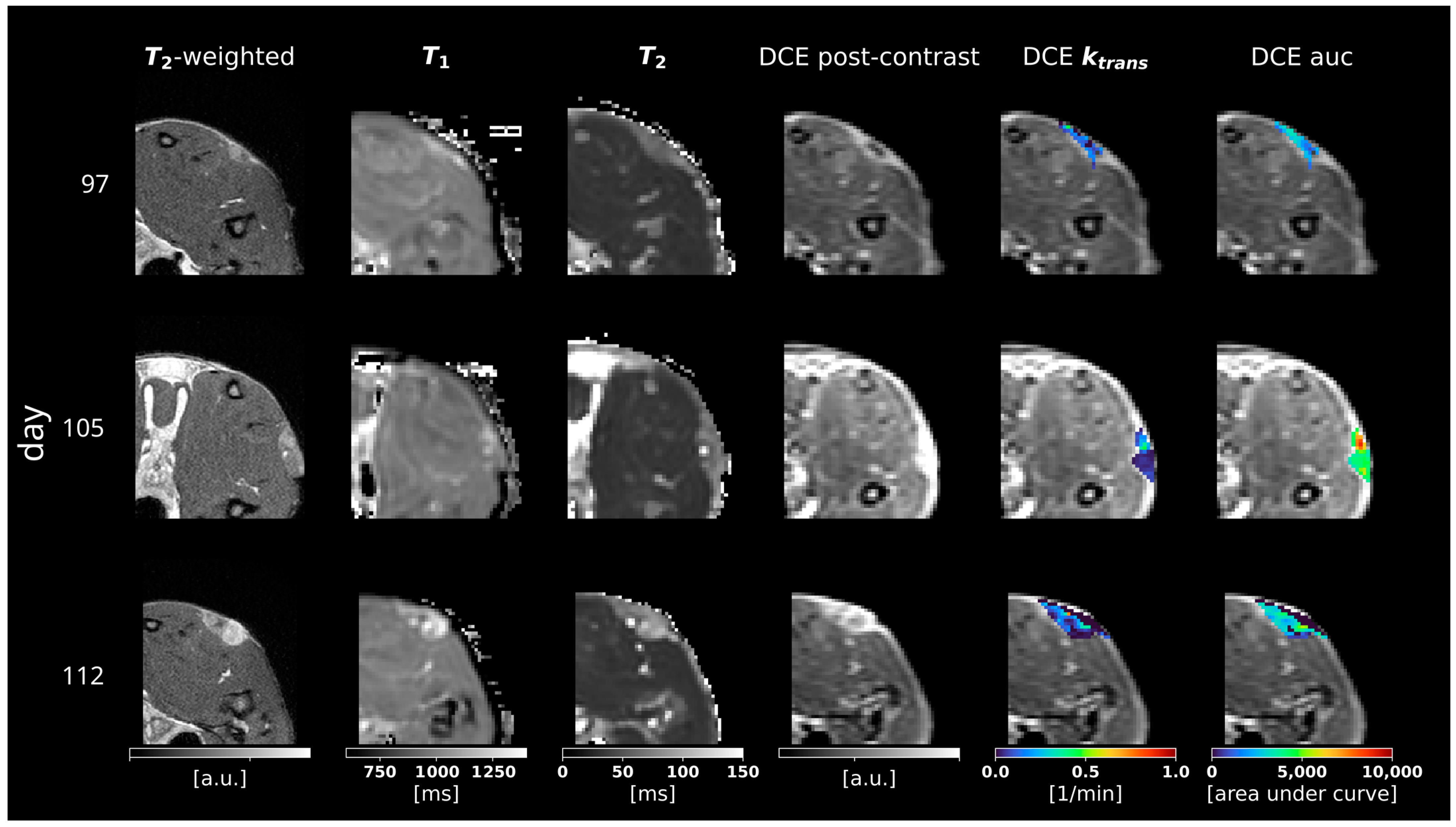 Cancers 16 01535 g005