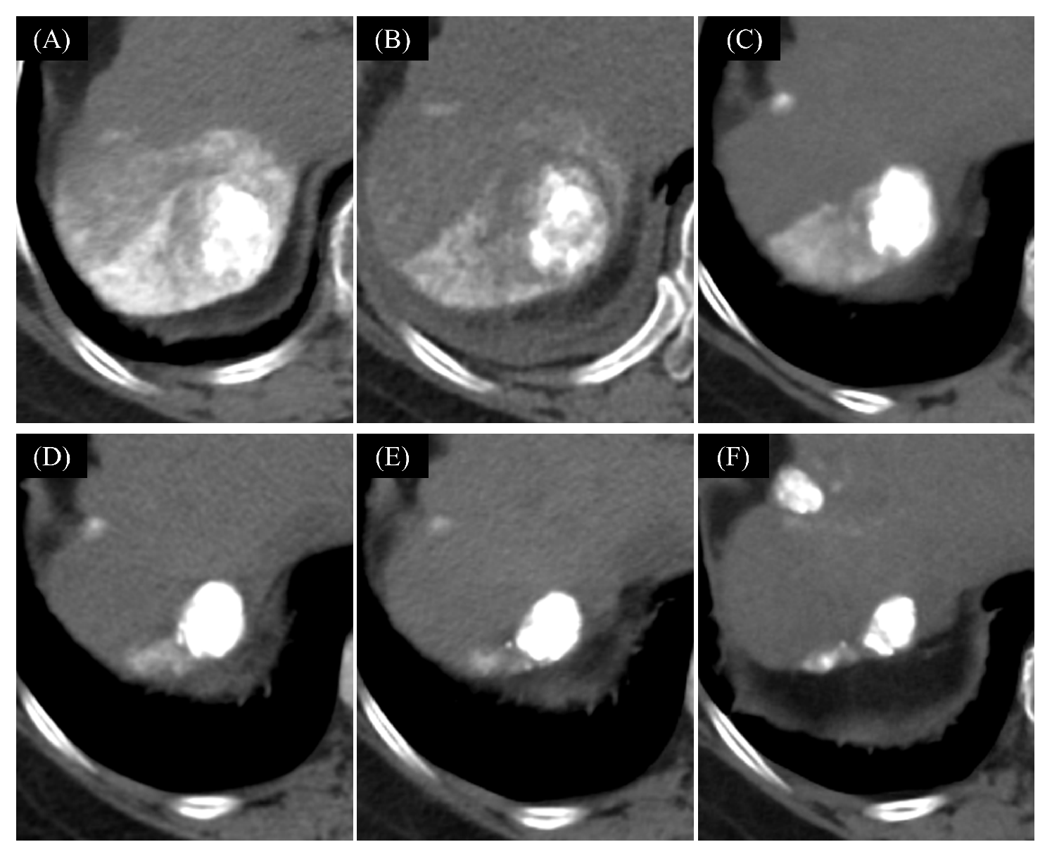 Cancers 16 01624 g006