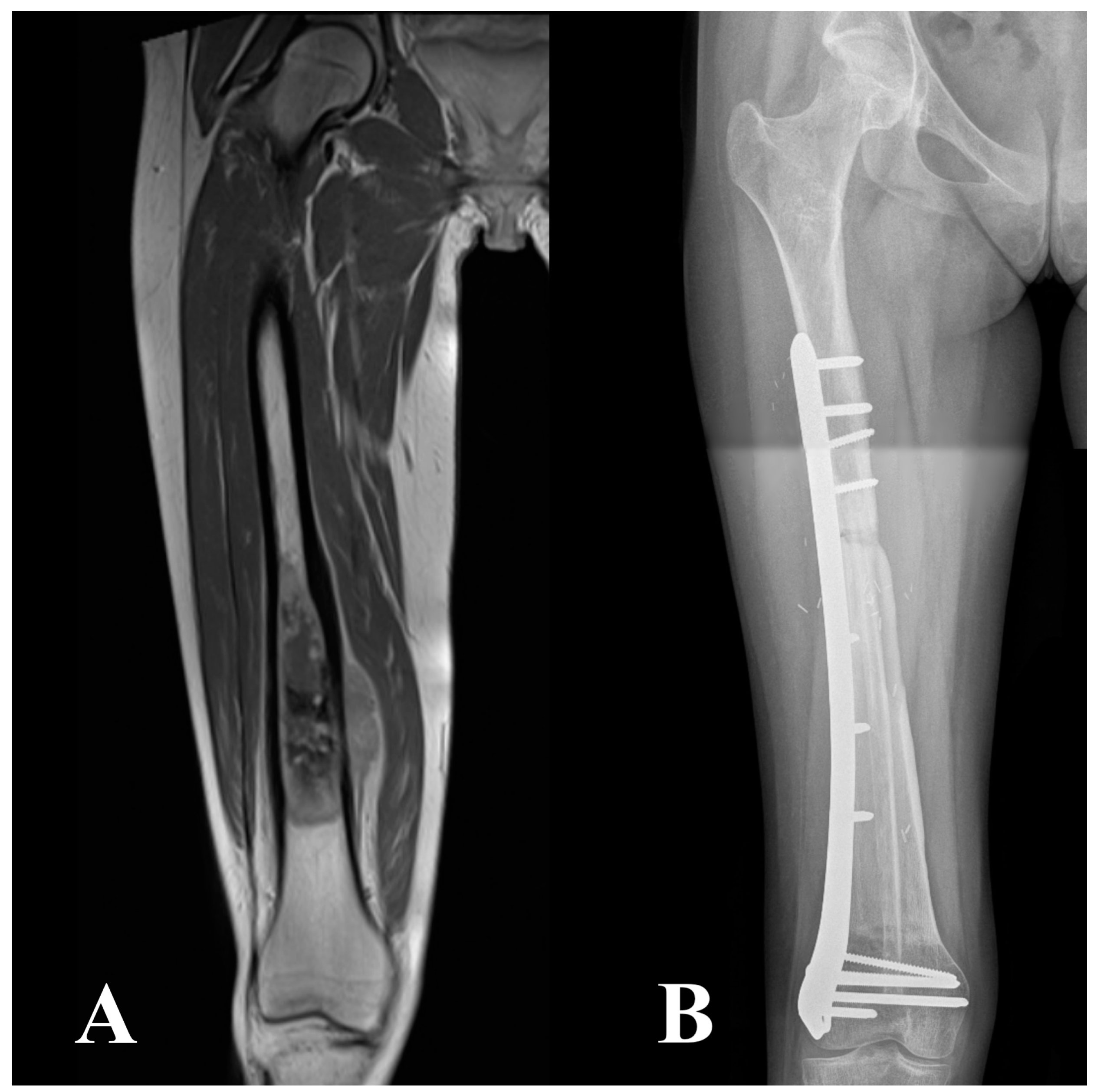 Cancers 16 01672 g001