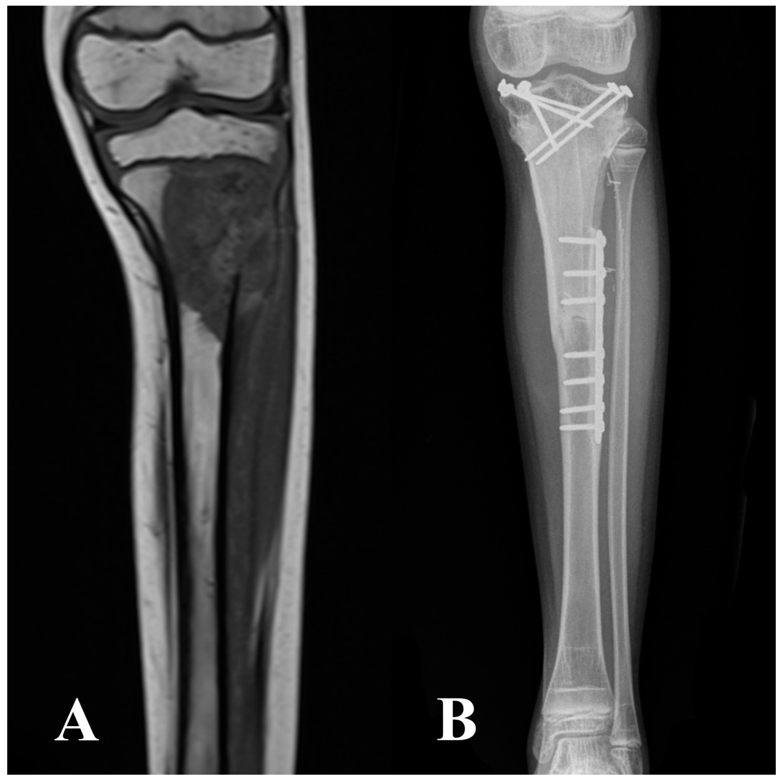 Cancers 16 01672 g002