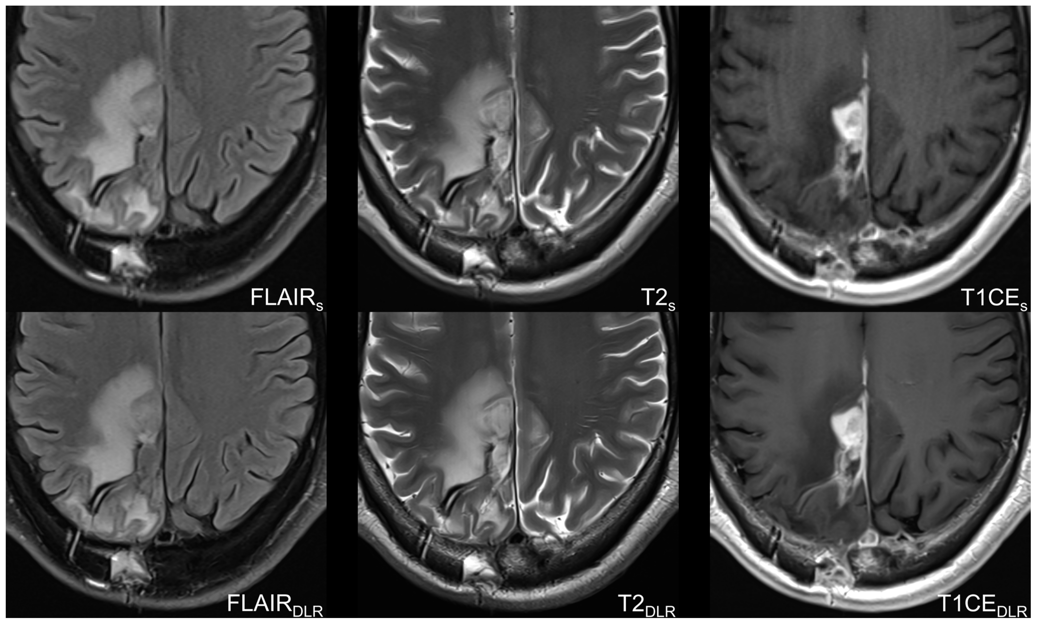 Cancers 16 01827 g002