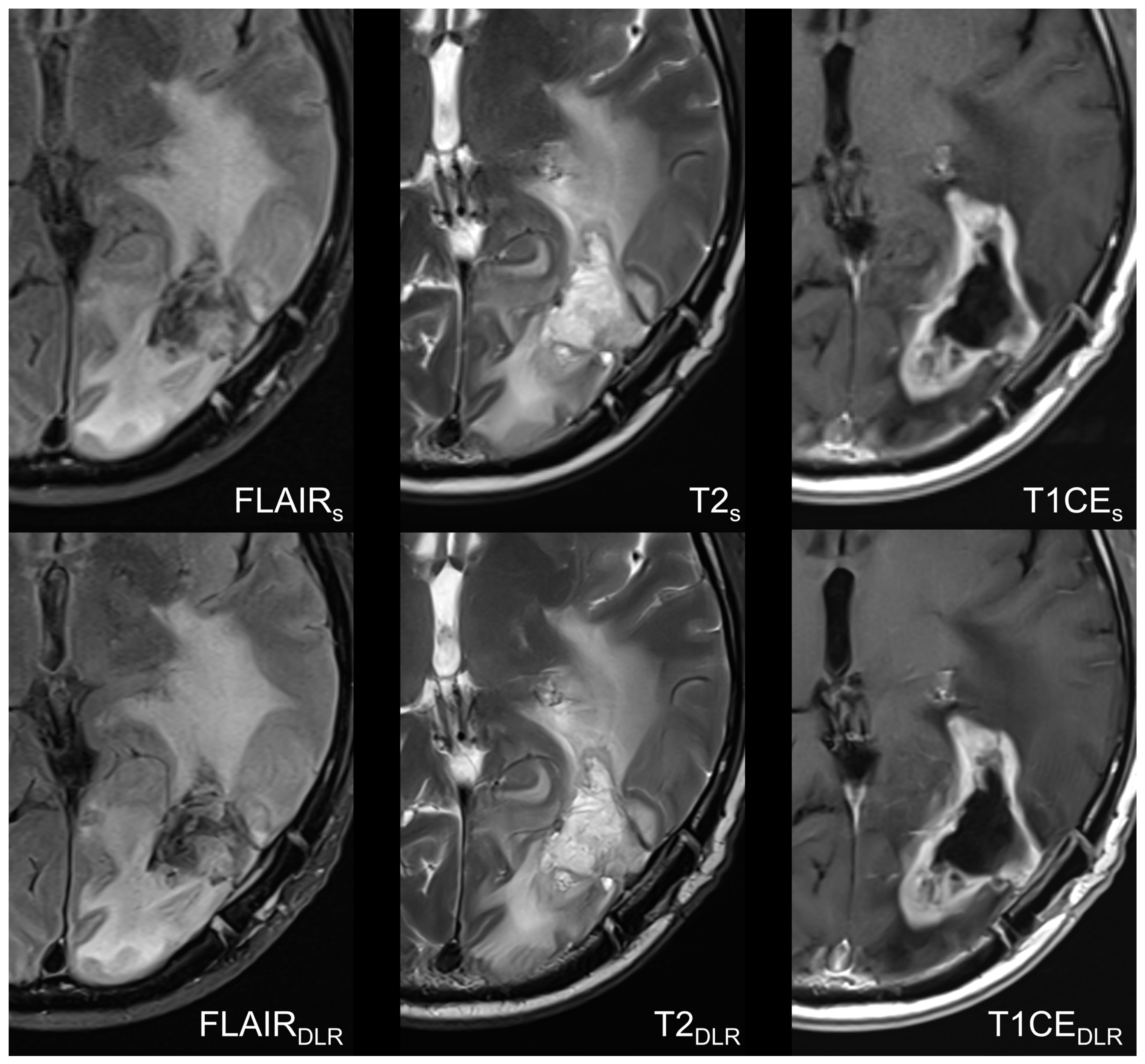 Cancers 16 01827 g003