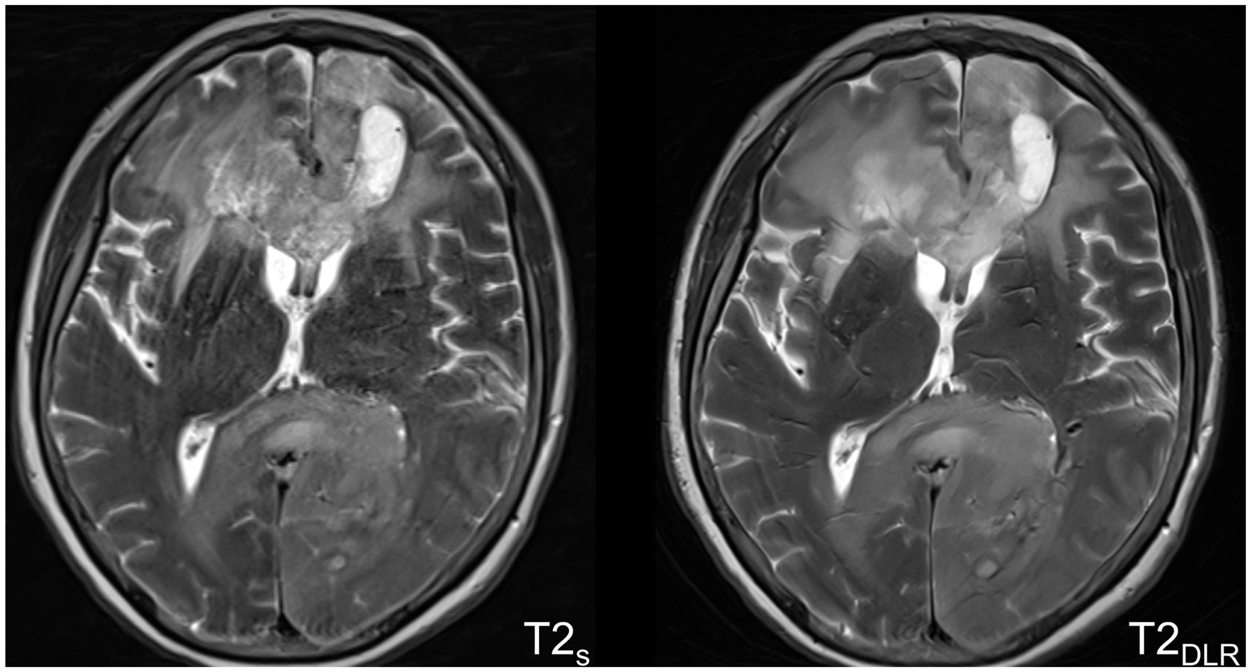 Cancers 16 01827 g004