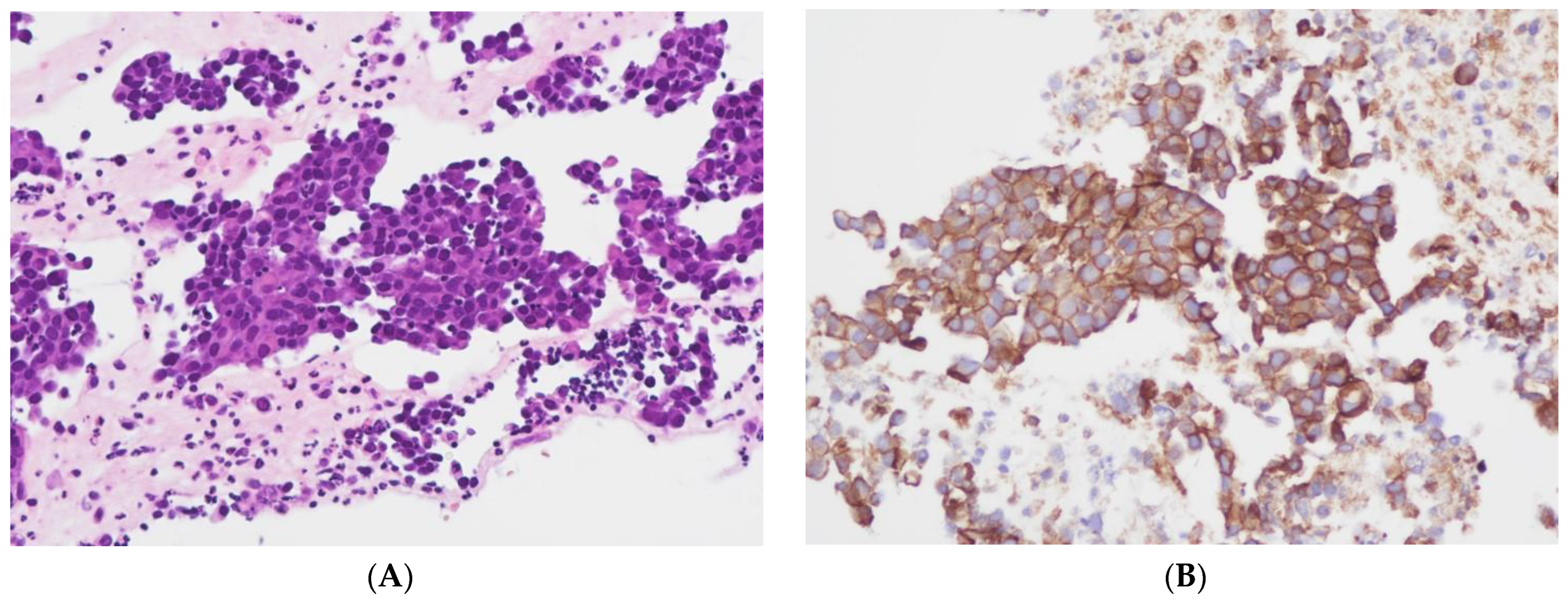 Cancers 16 01841 g002