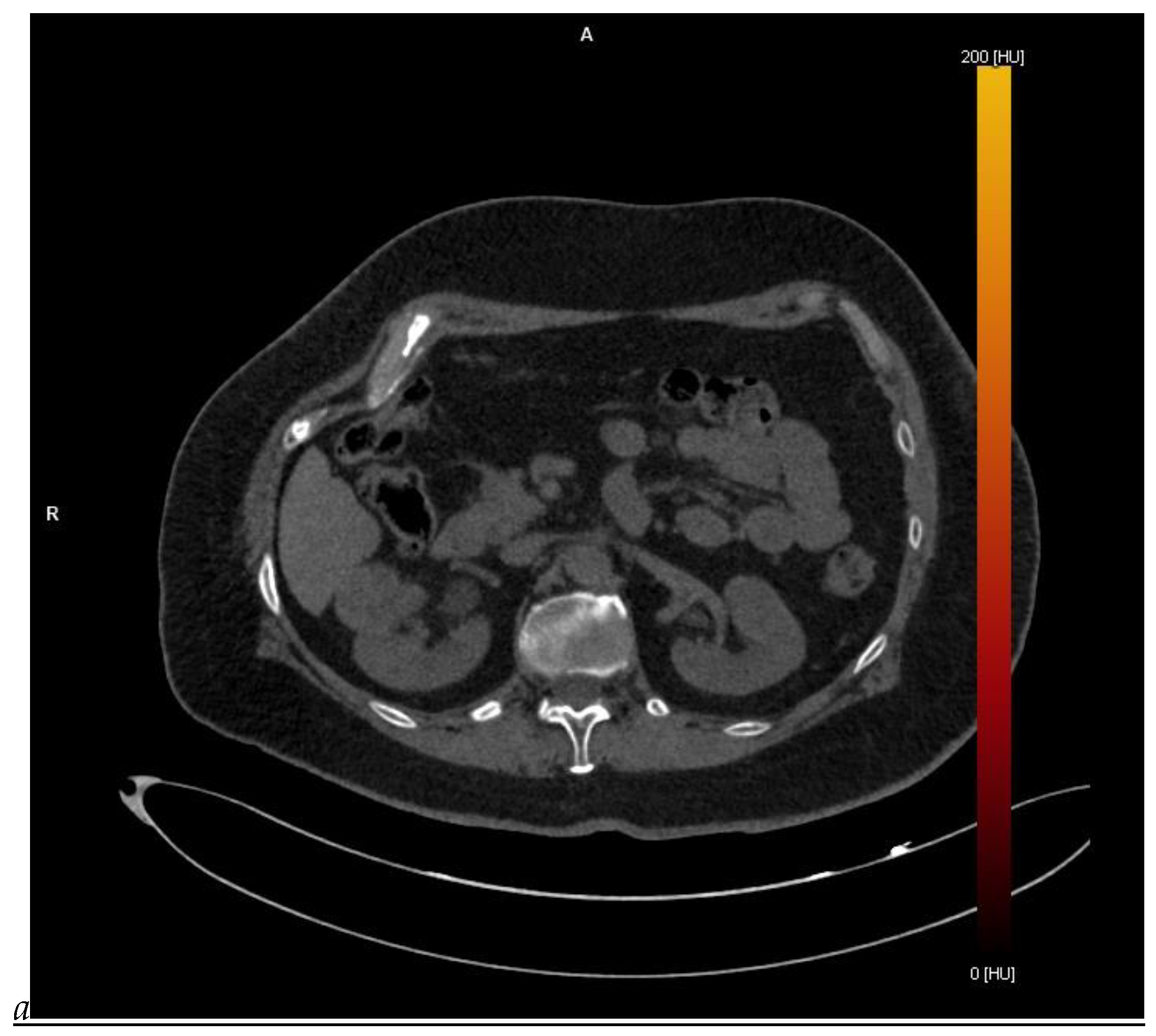 Cancers 16 01926 g001a
