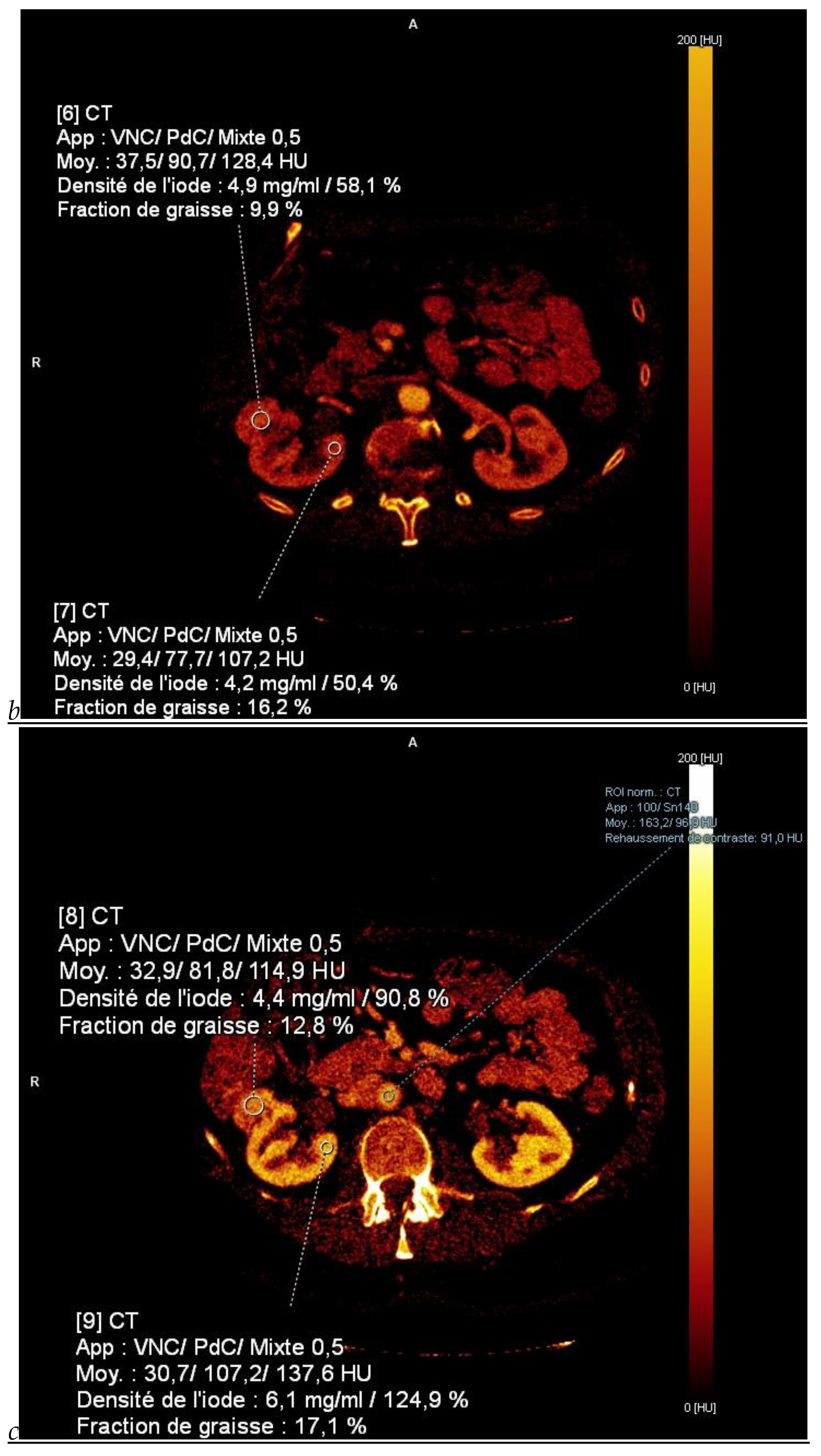 Cancers 16 01926 g001b