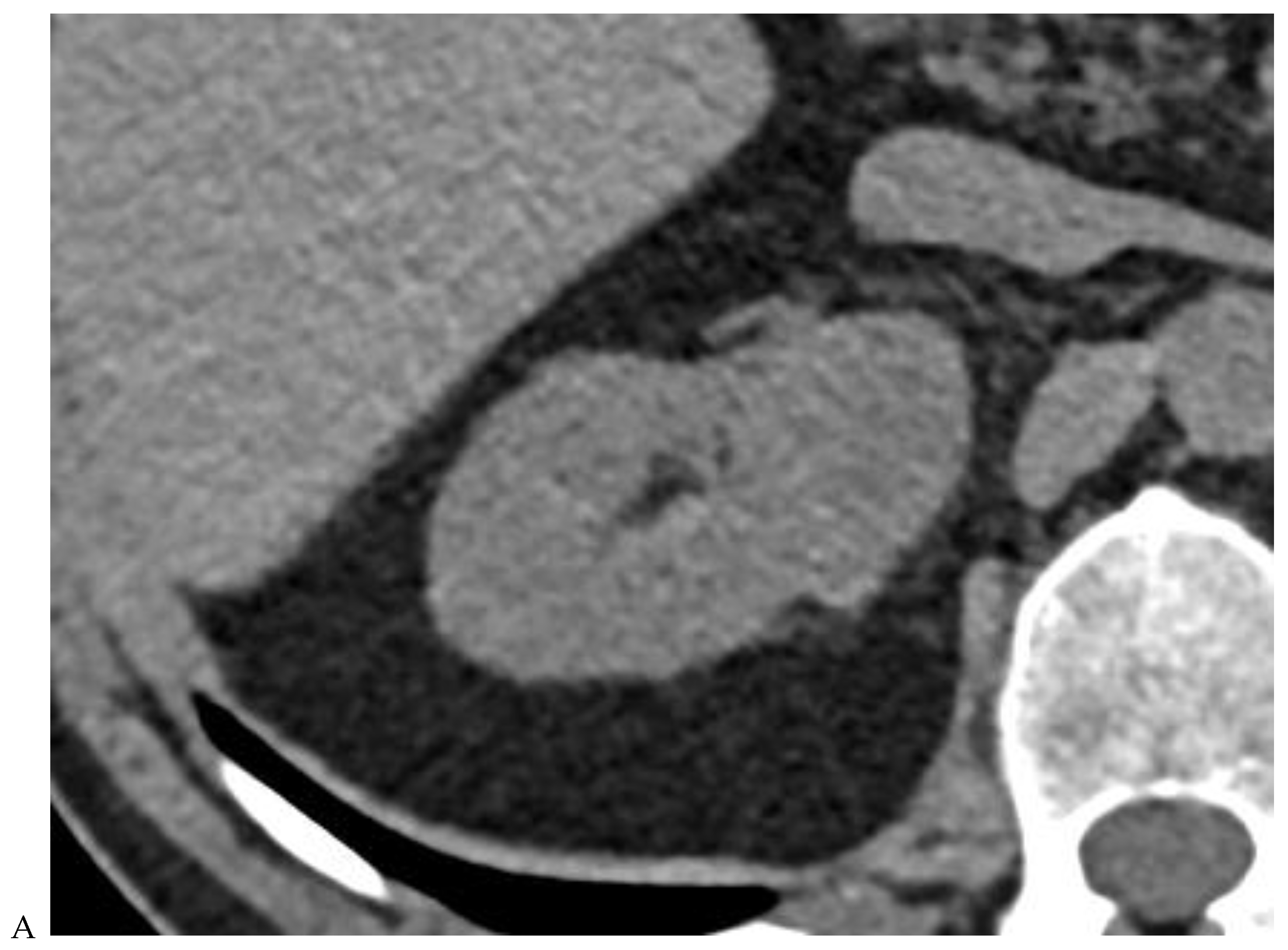 Cancers 16 01926 g002a