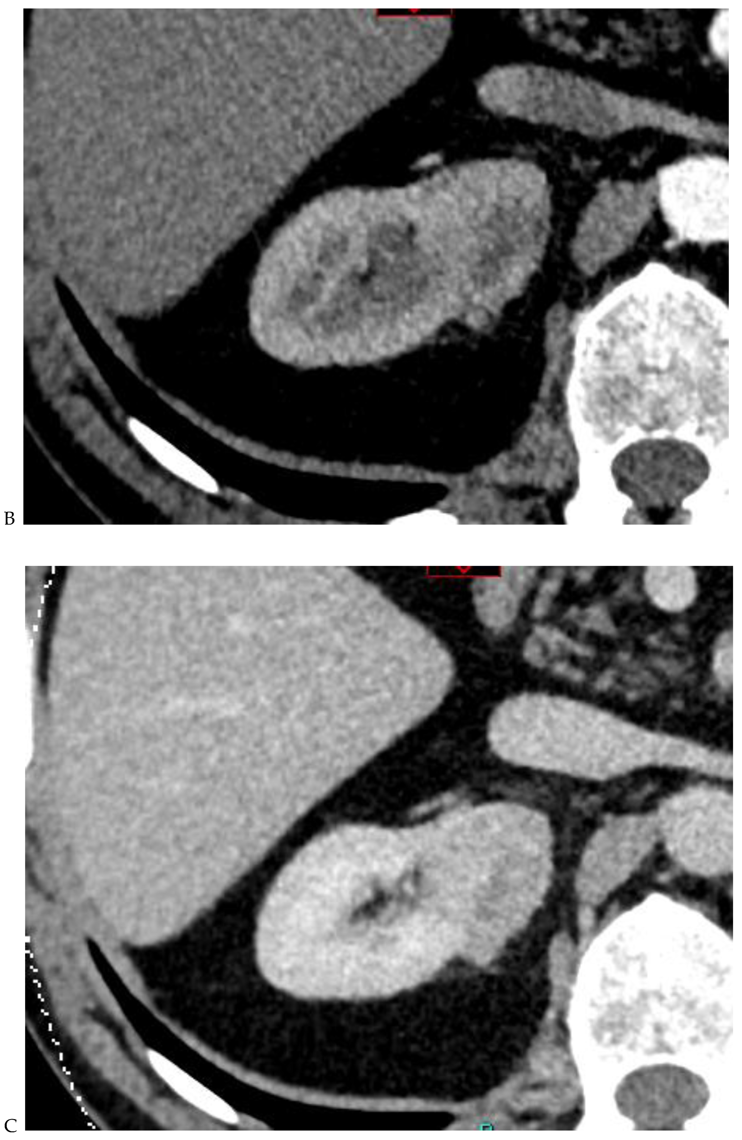 Cancers 16 01926 g002b