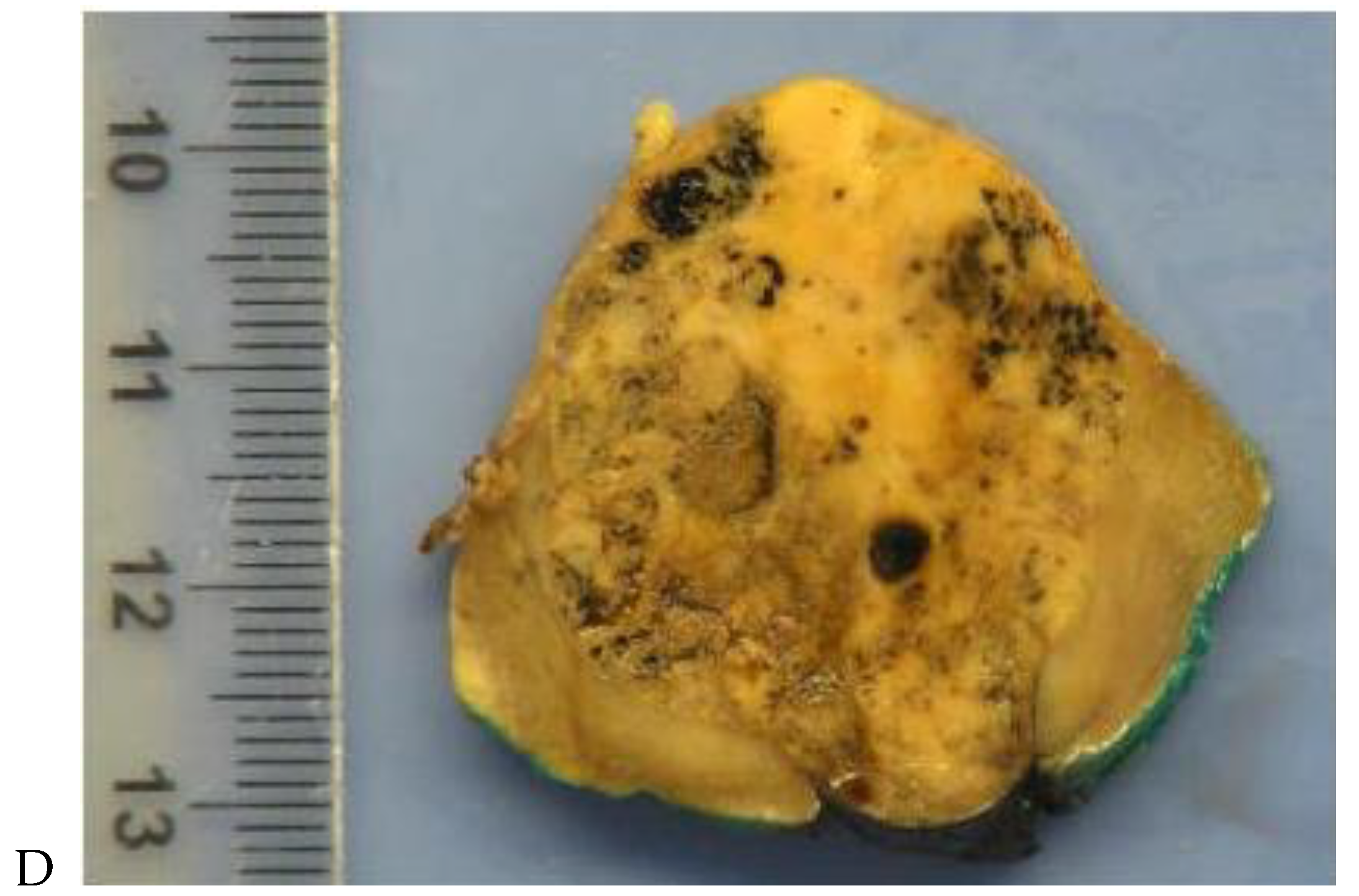 Cancers 16 01926 g003b