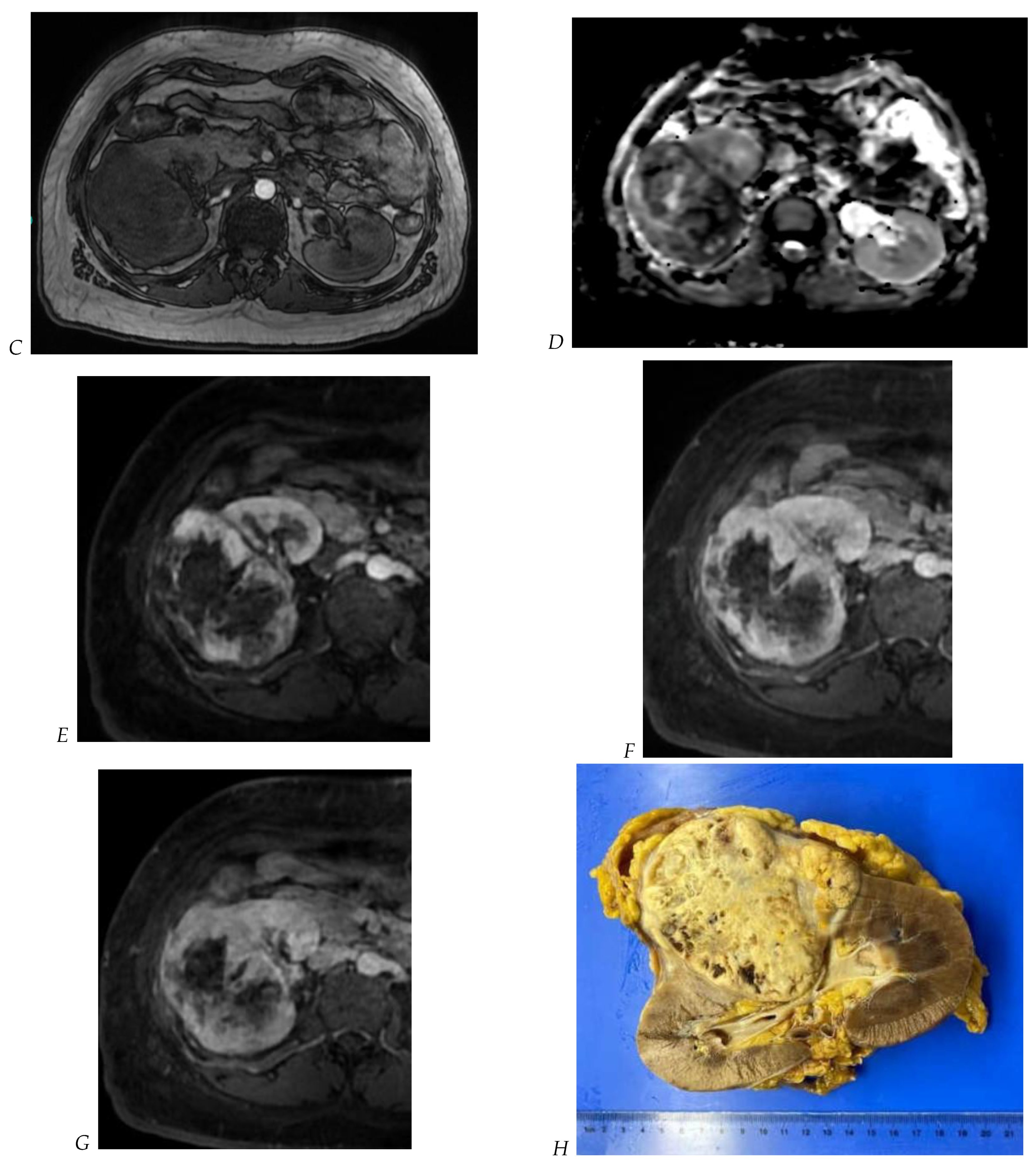 Cancers 16 01926 g005b