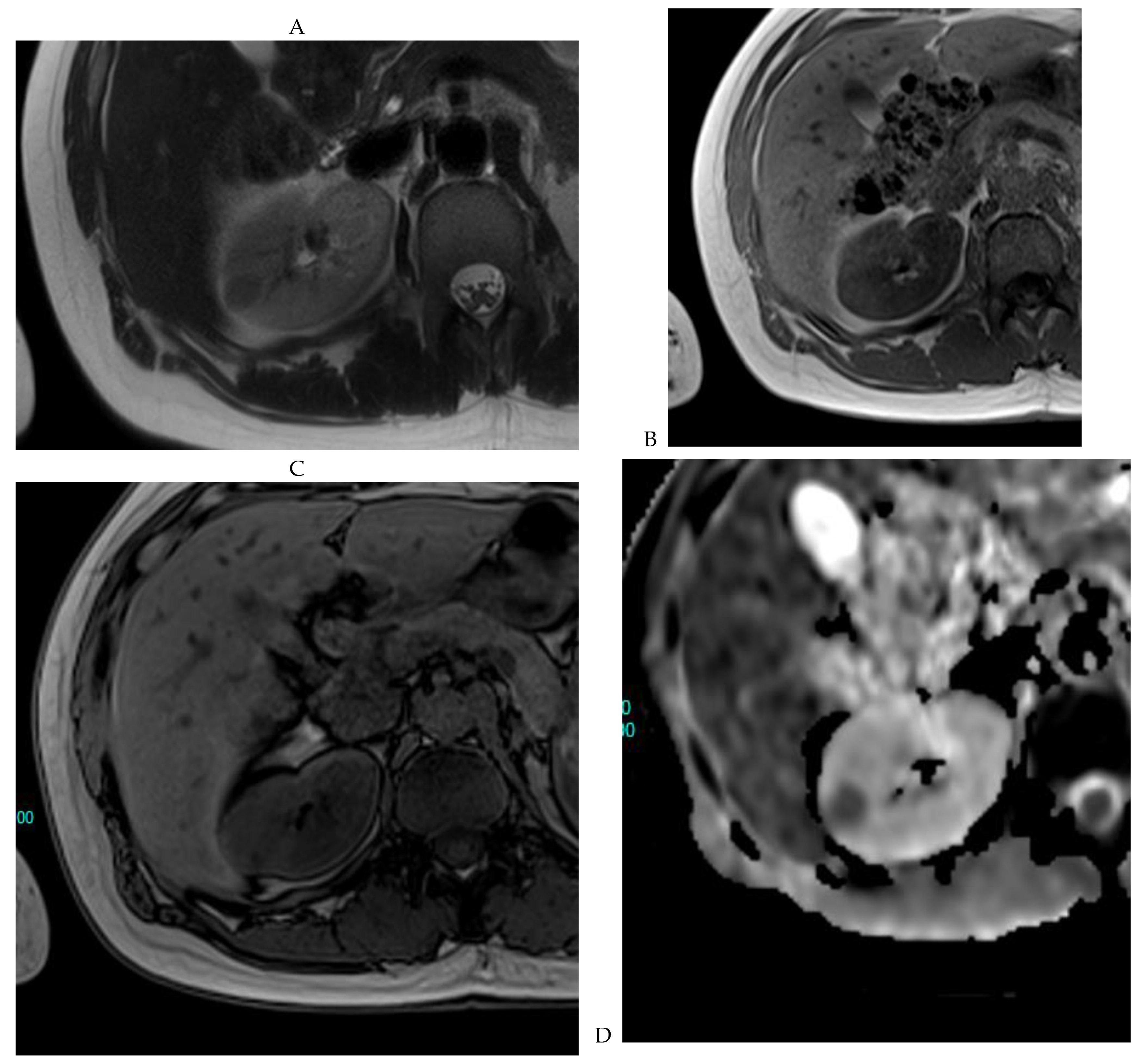 Cancers 16 01926 g007a