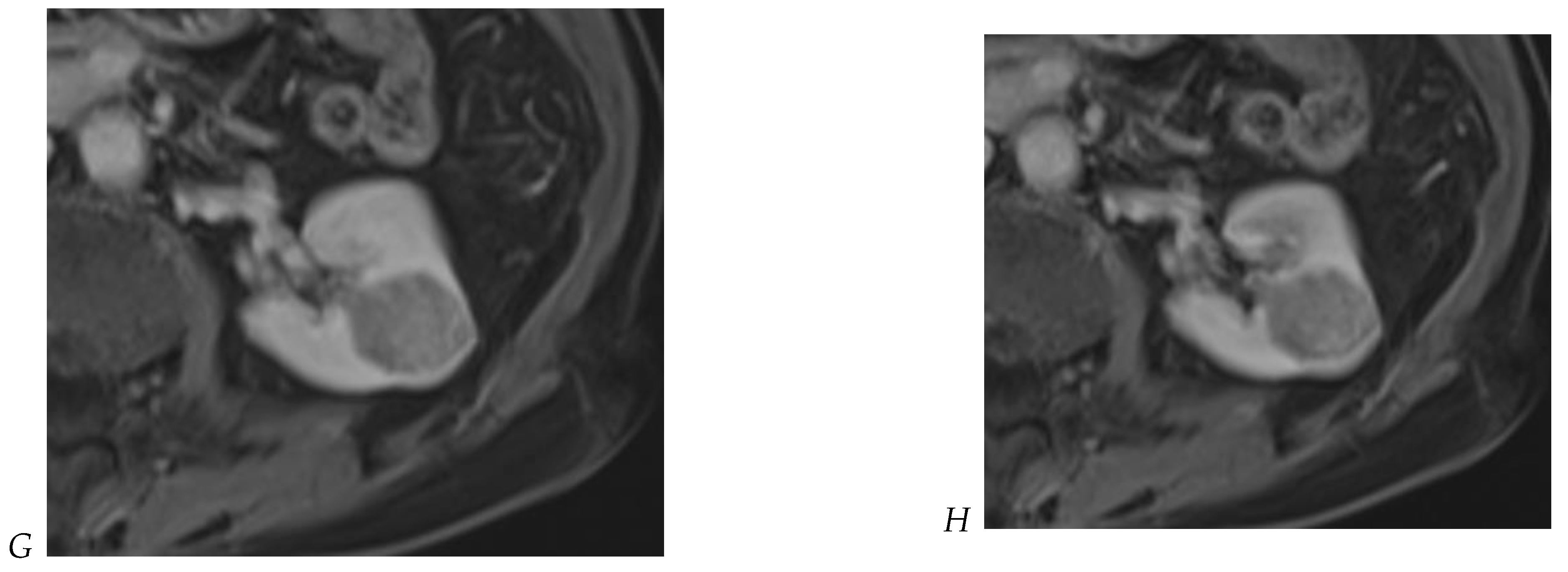 Cancers 16 01926 g008b