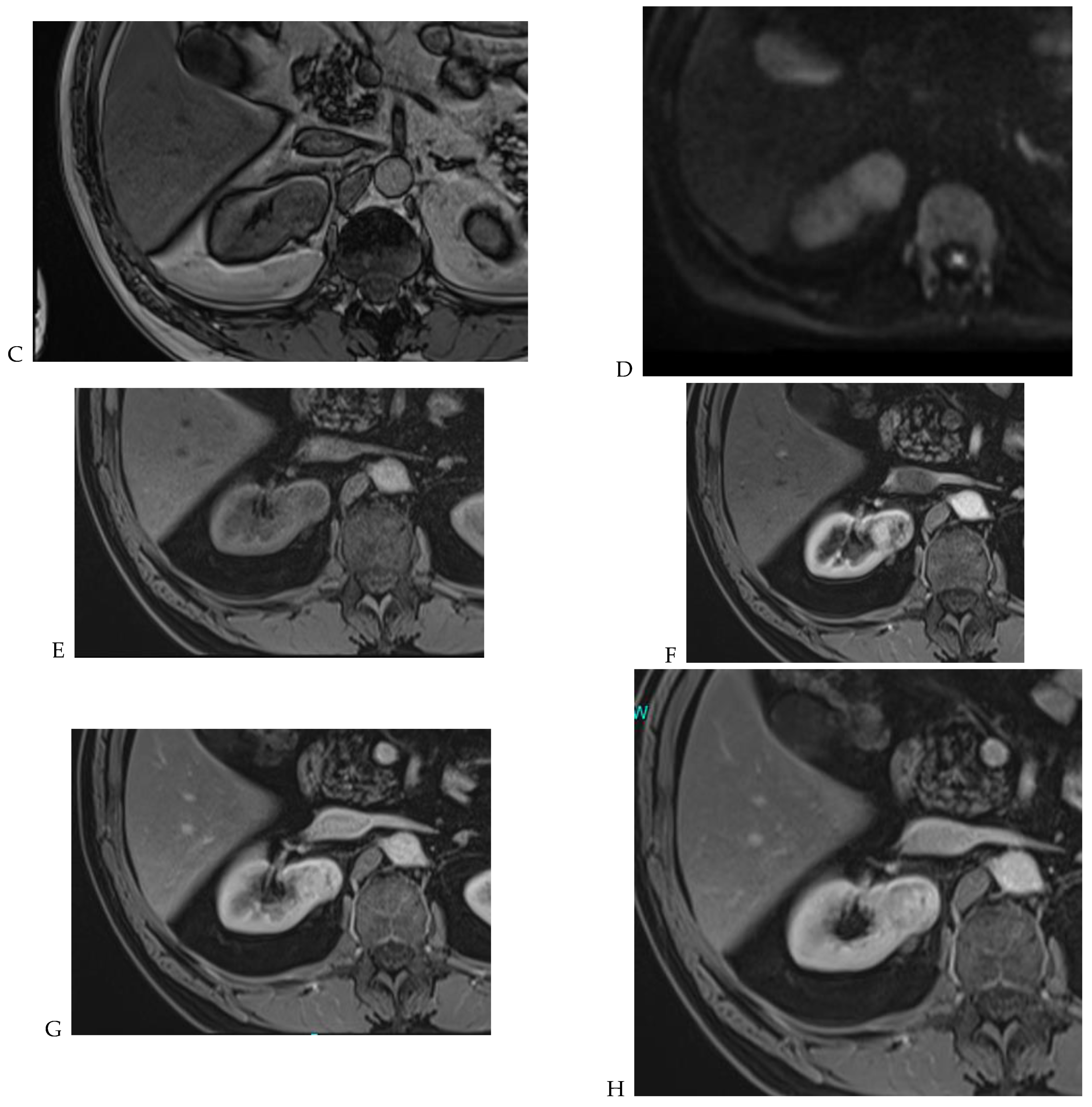 Cancers 16 01926 g009b