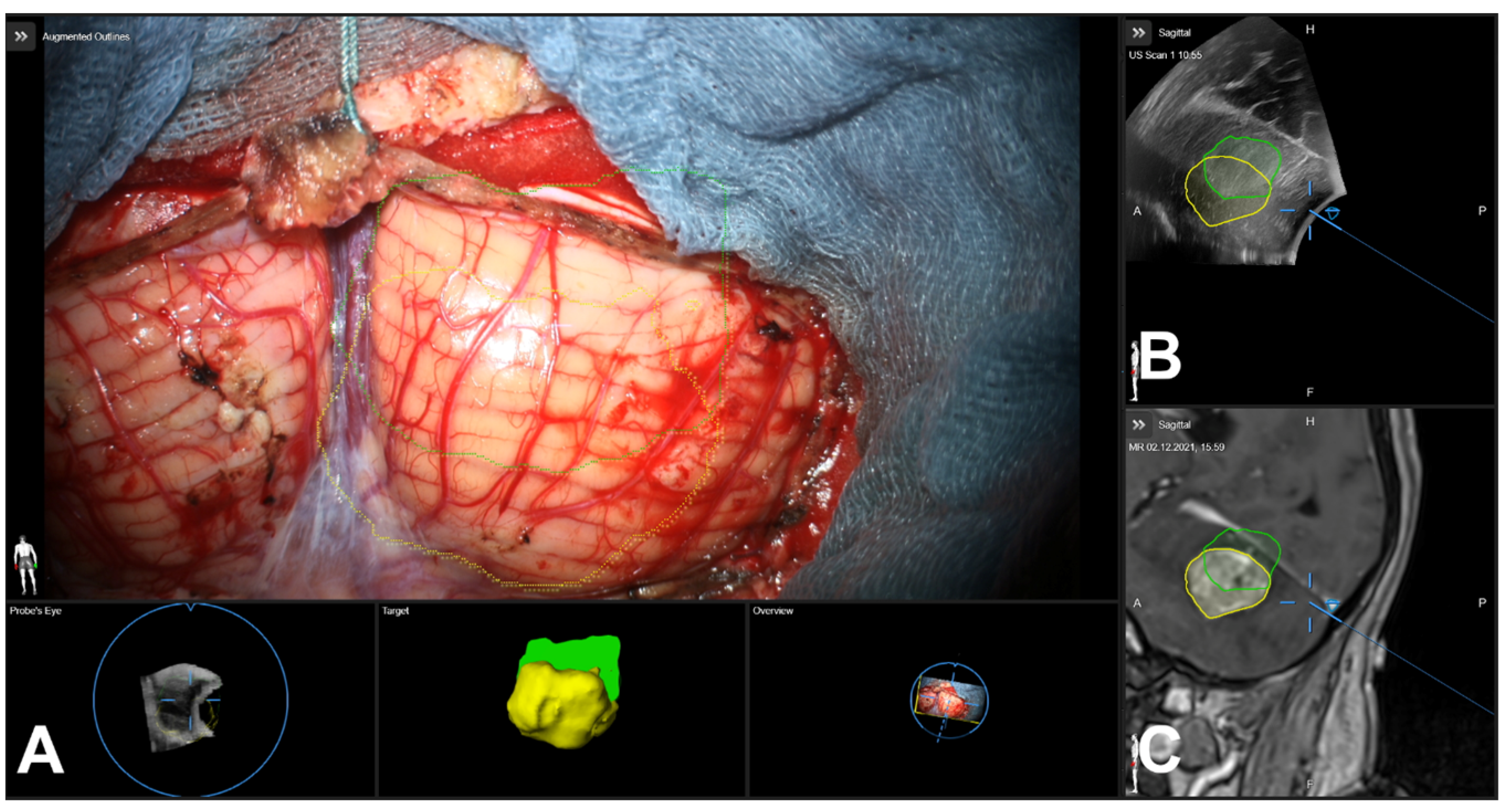 Cancers 16 01985 g002