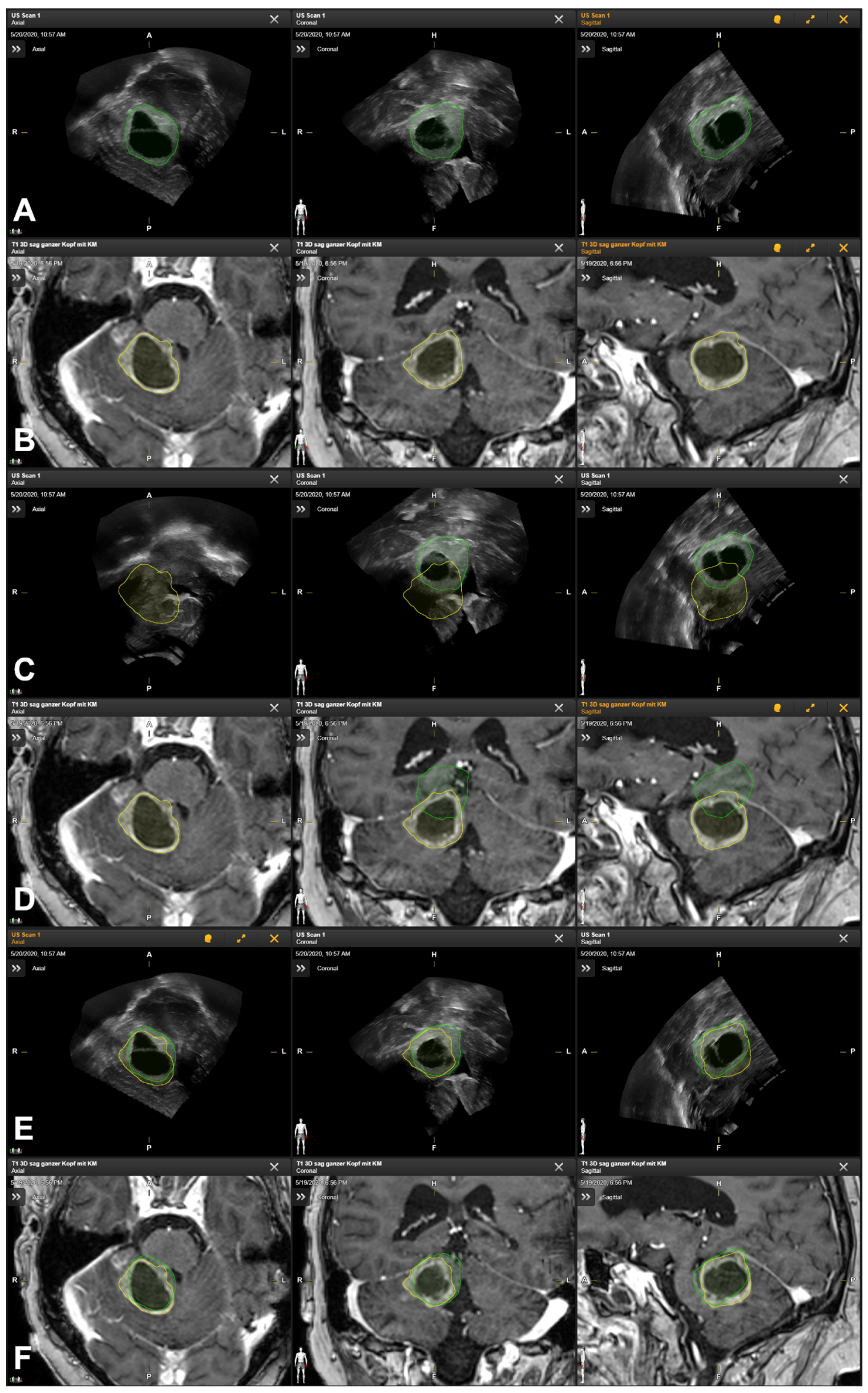 Cancers 16 01985 g004