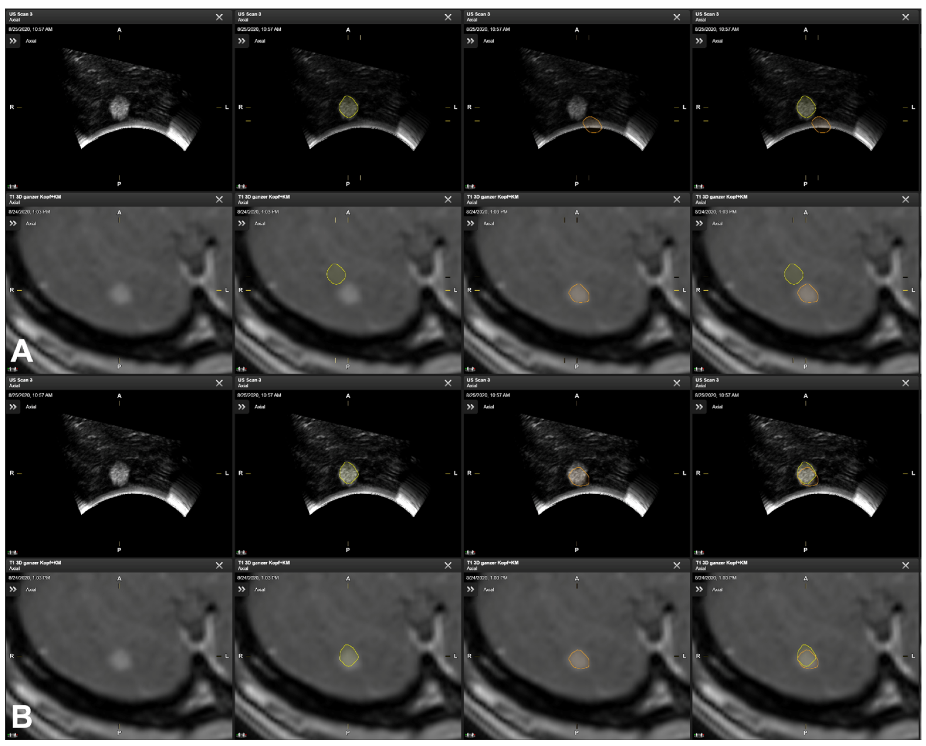 Cancers 16 01985 g005
