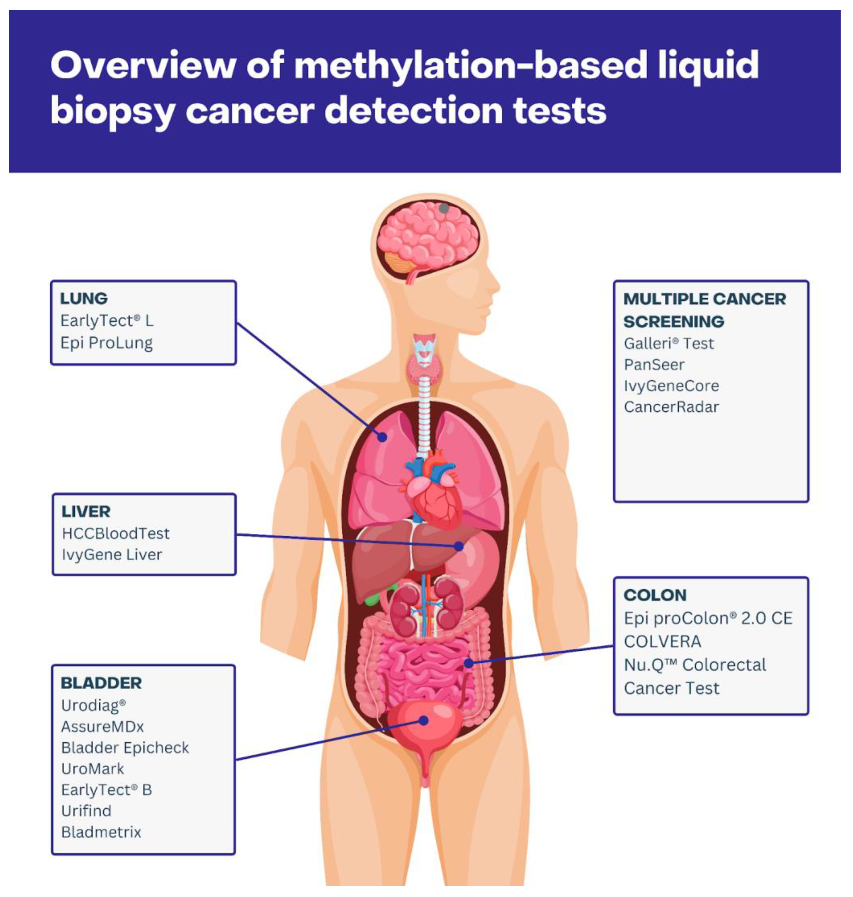 Cancers 16 02001 g001