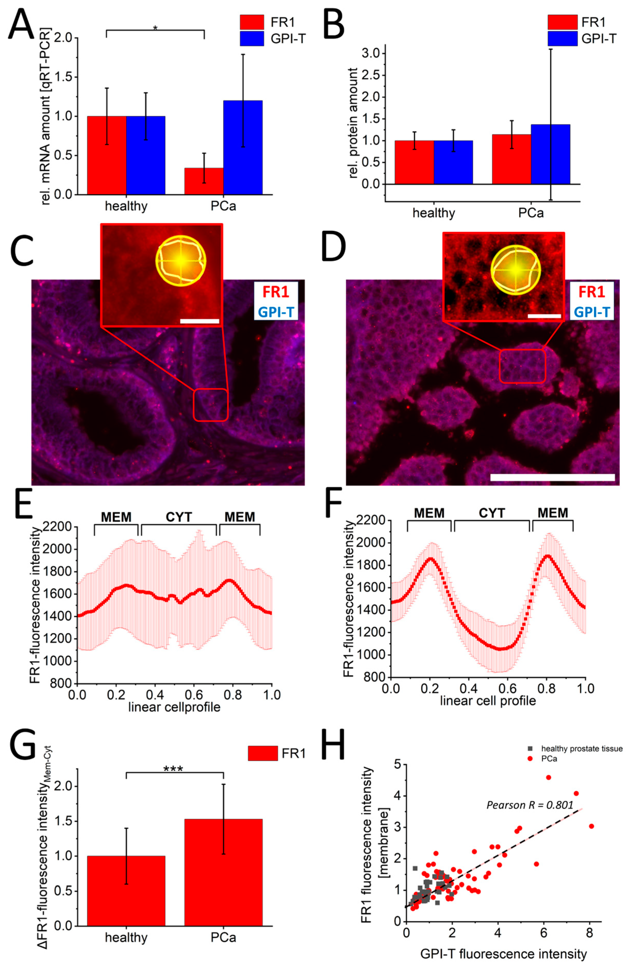Cancers 16 02008 g004