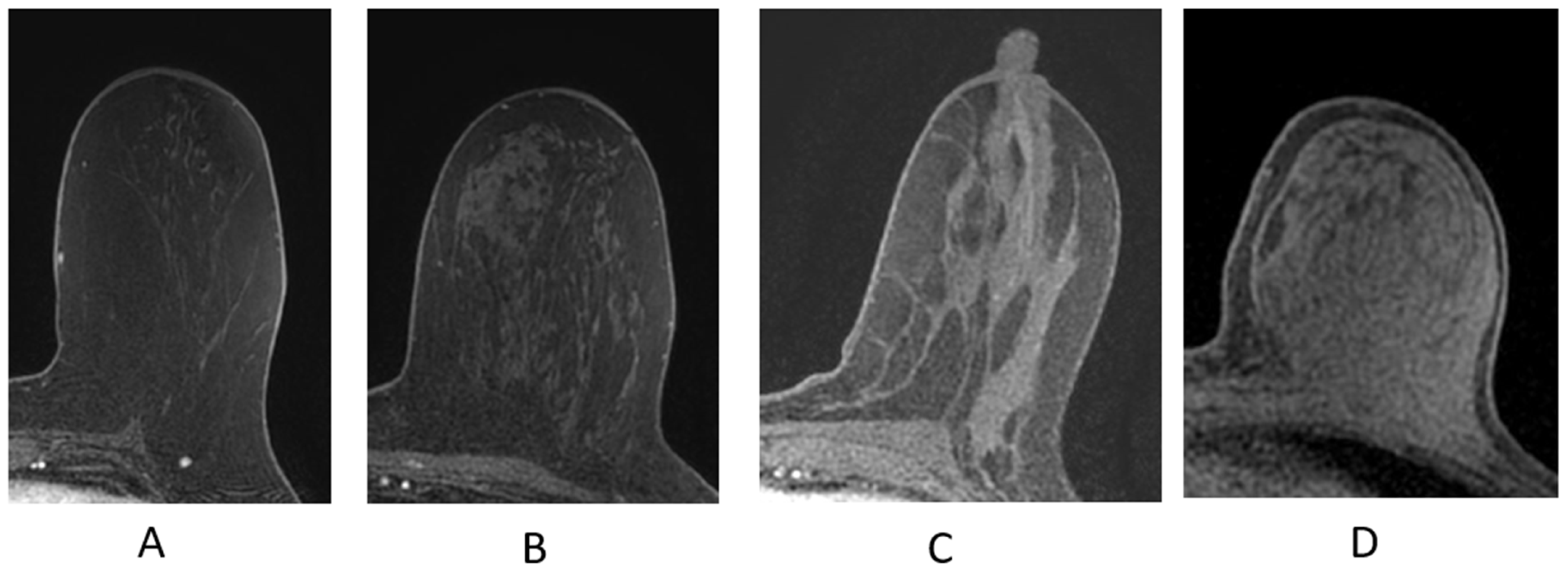 Cancers 16 02122 g004