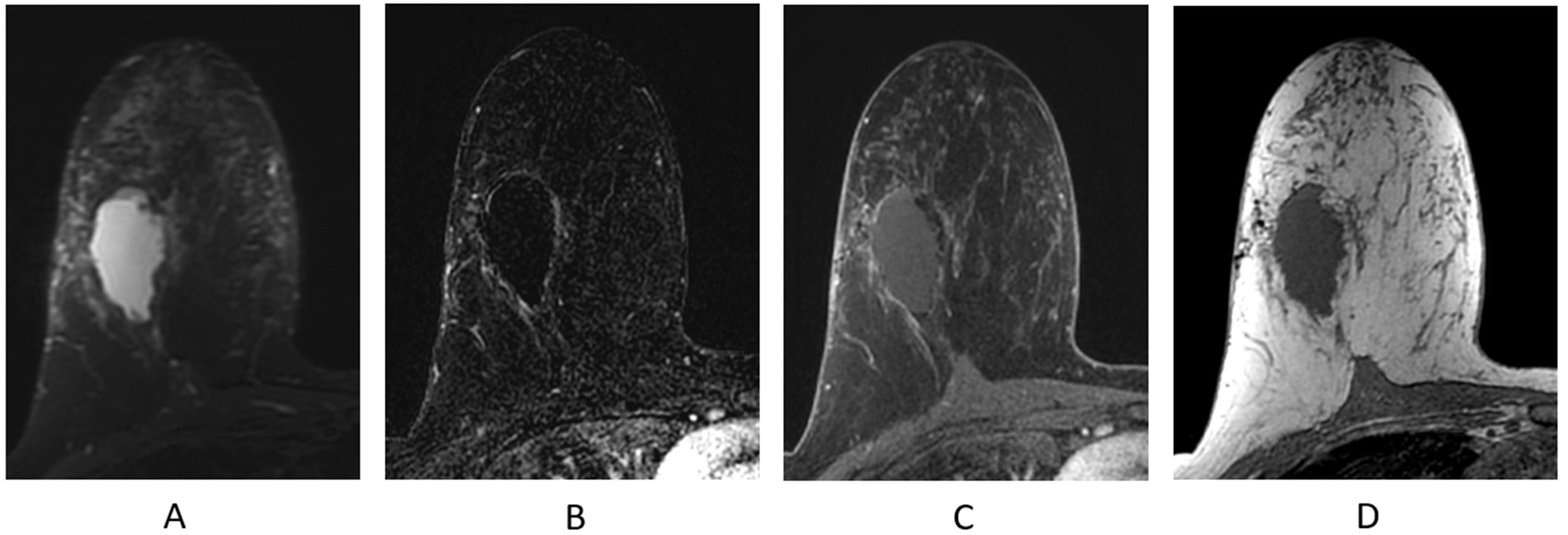 Cancers 16 02122 g011