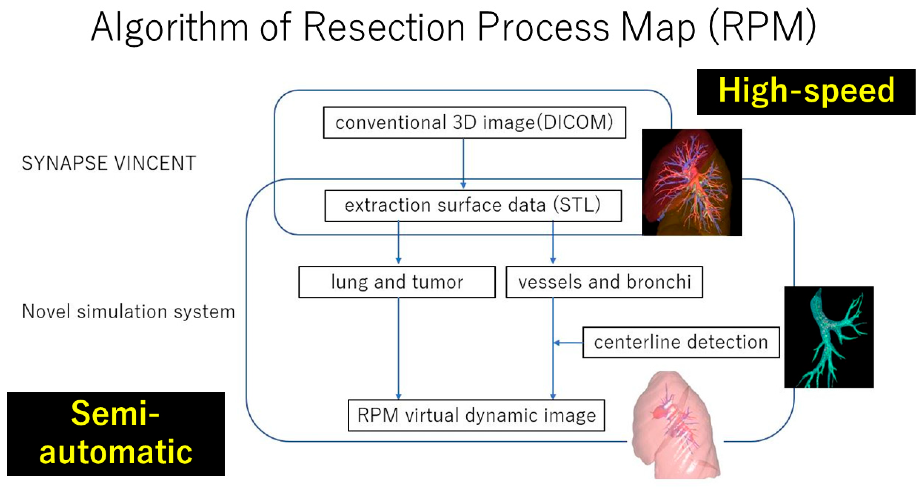 Cancers 16 02161 g003