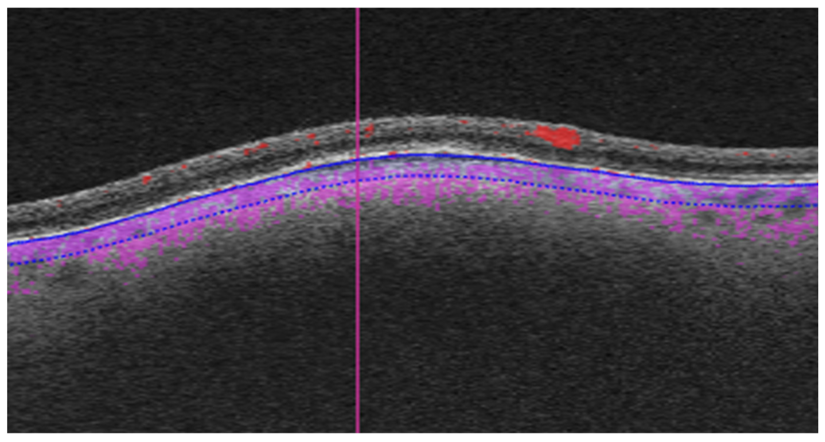 Cancers 16 02167 g001