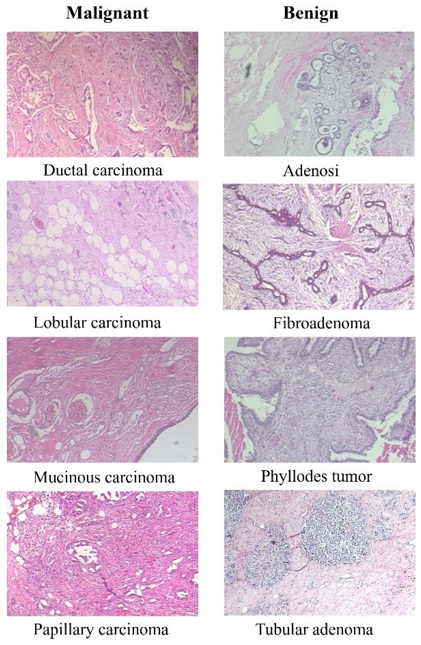 Cancers 16 02222 g002