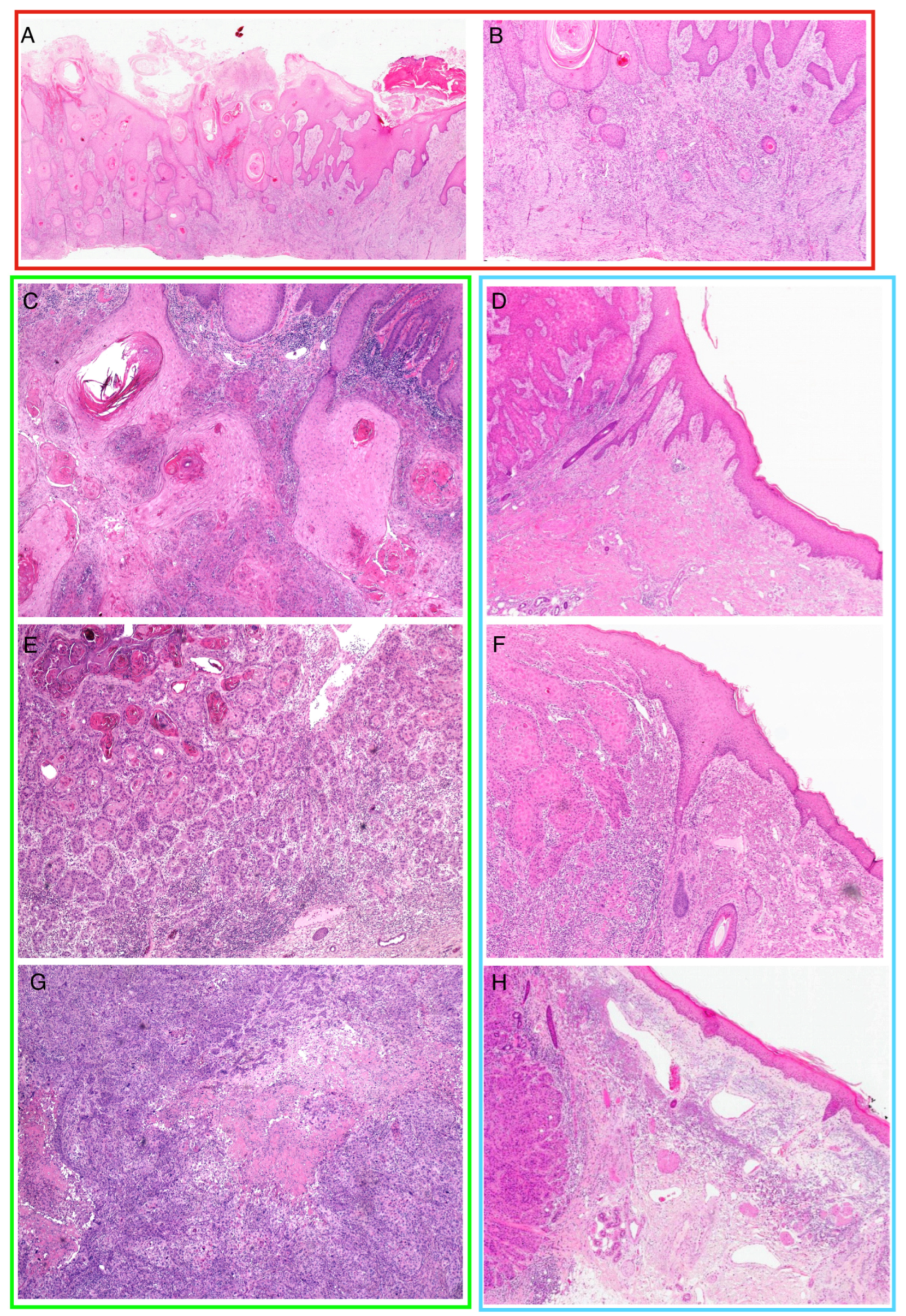 Cancers 16 02233 g001