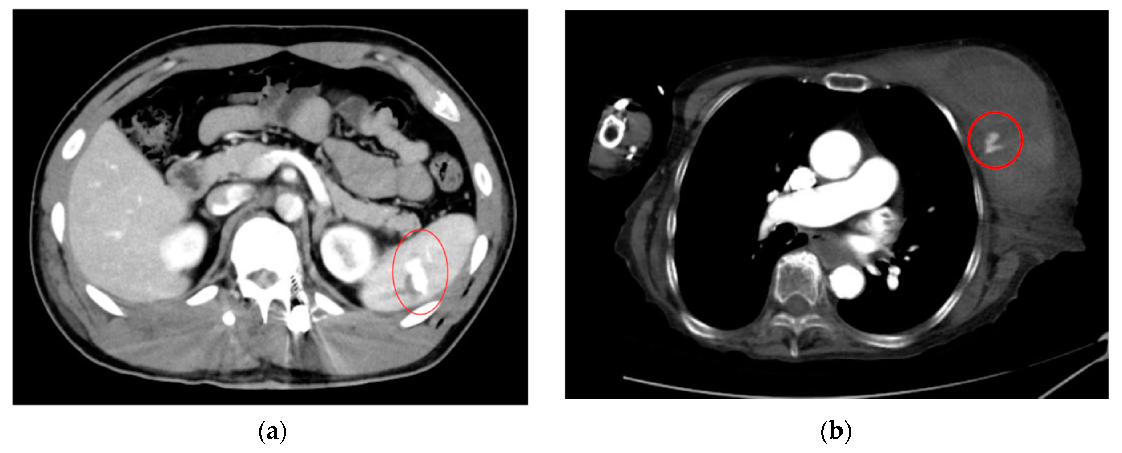 Cancers 16 02308 g002