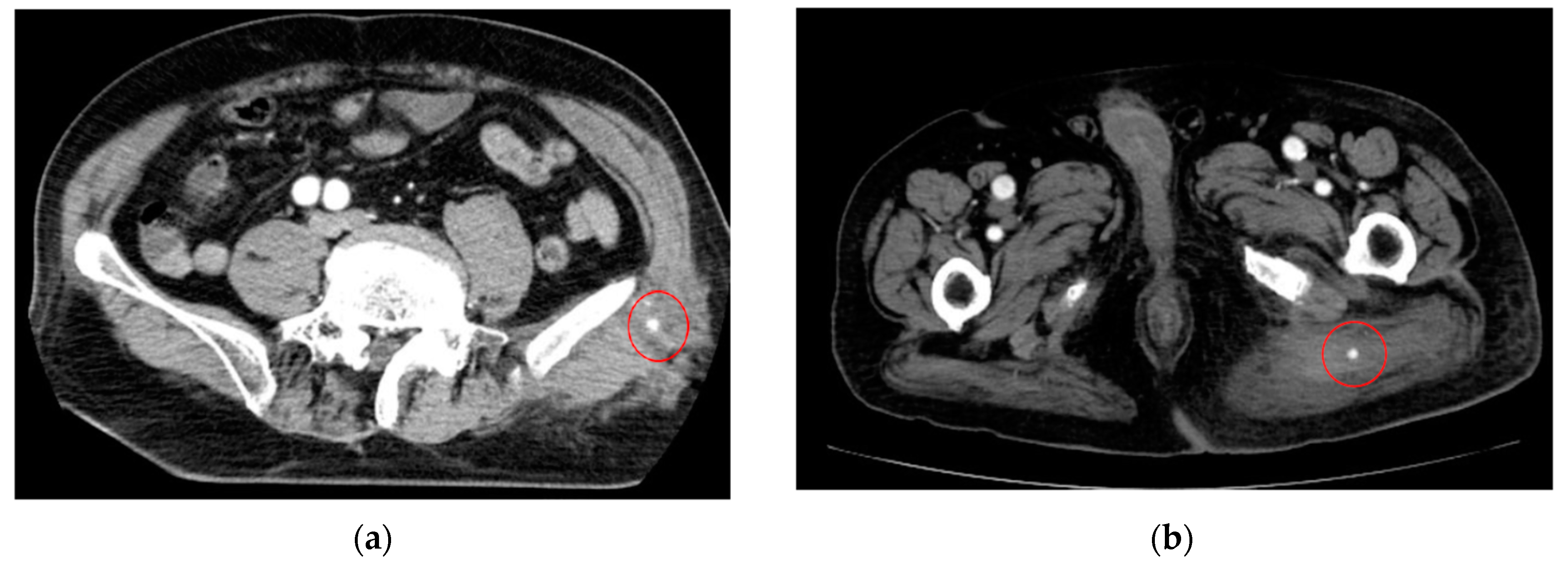 Cancers 16 02308 g003