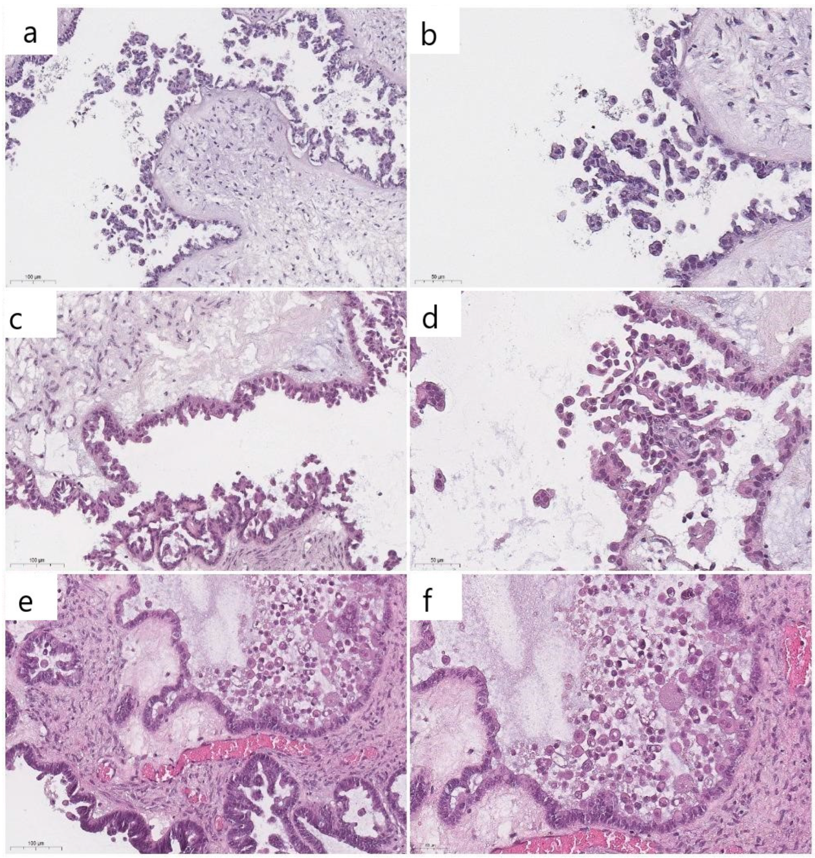 Cancers 16 02322 g004