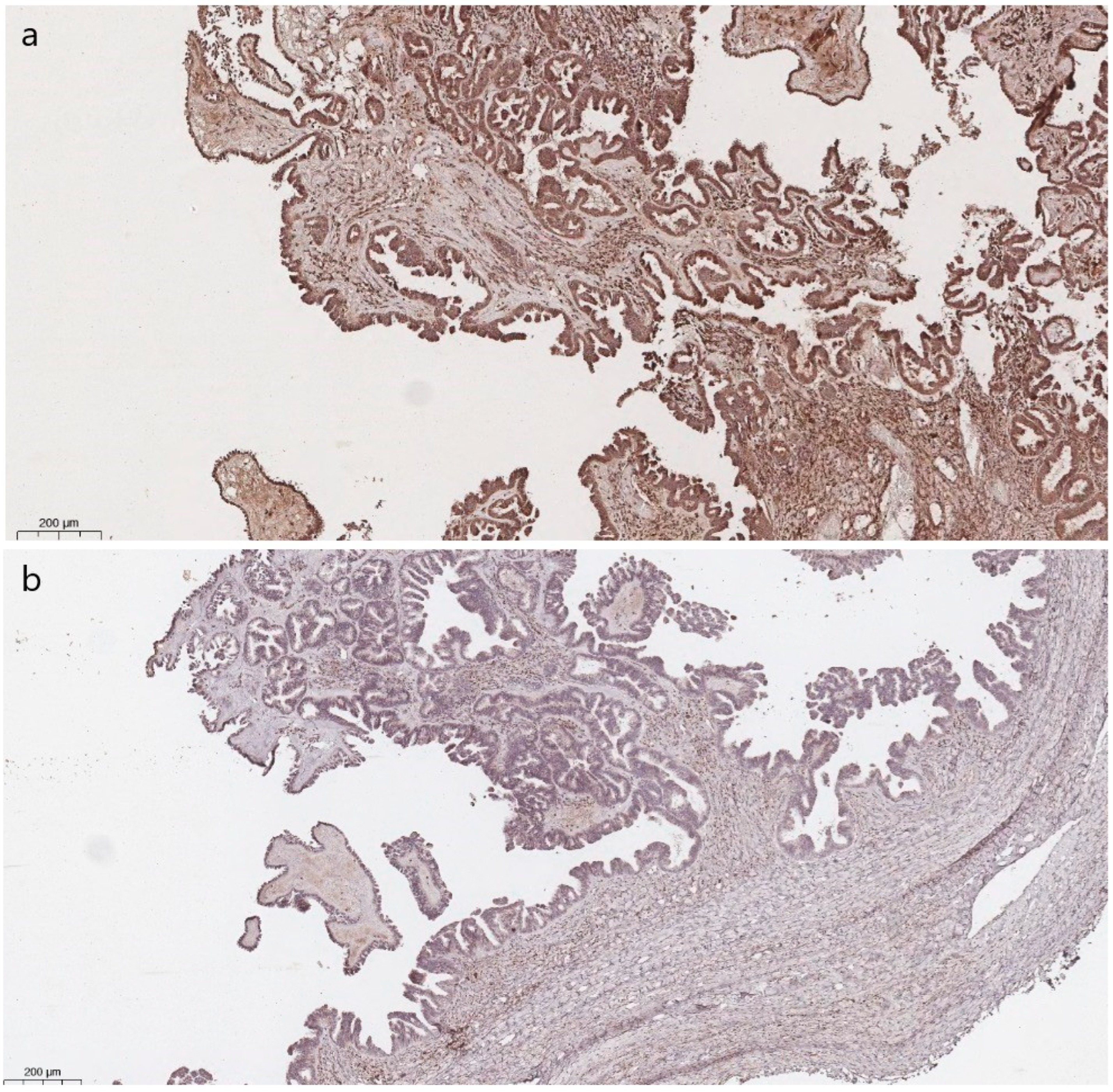 Cancers 16 02322 g005