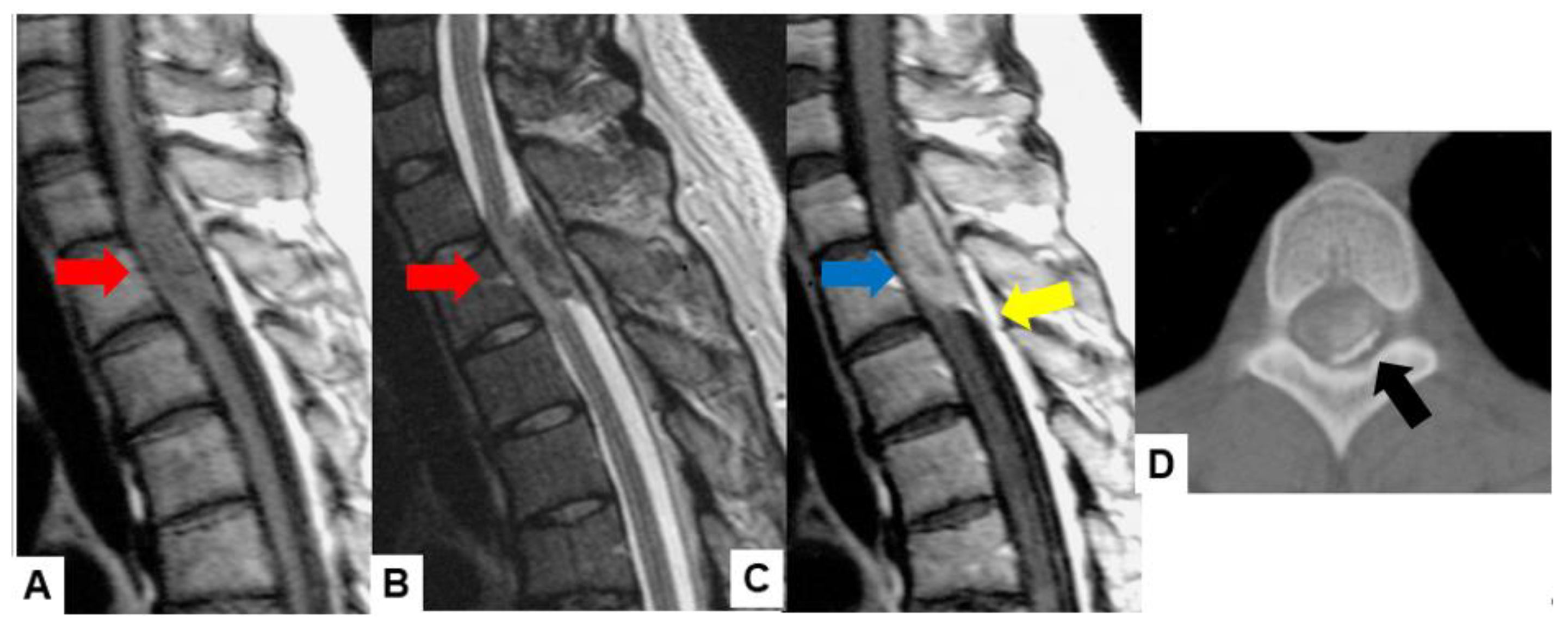 Cancers 16 02360 g003