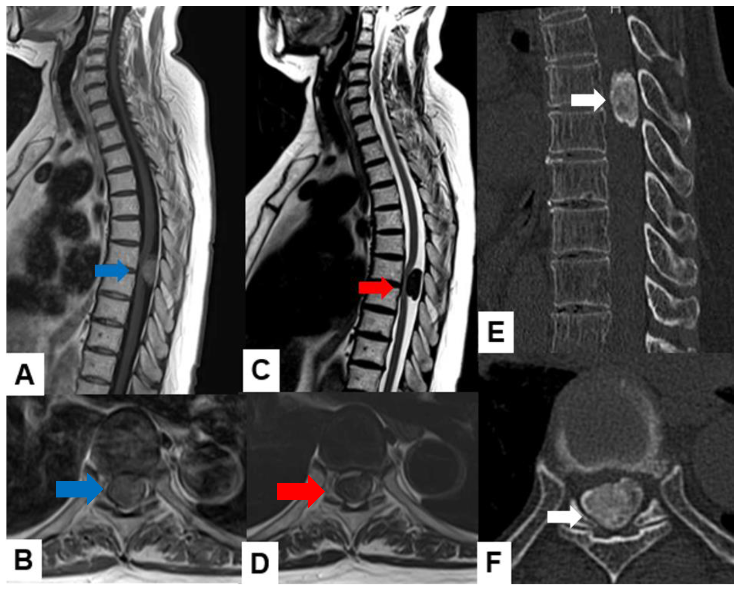 Cancers 16 02360 g004
