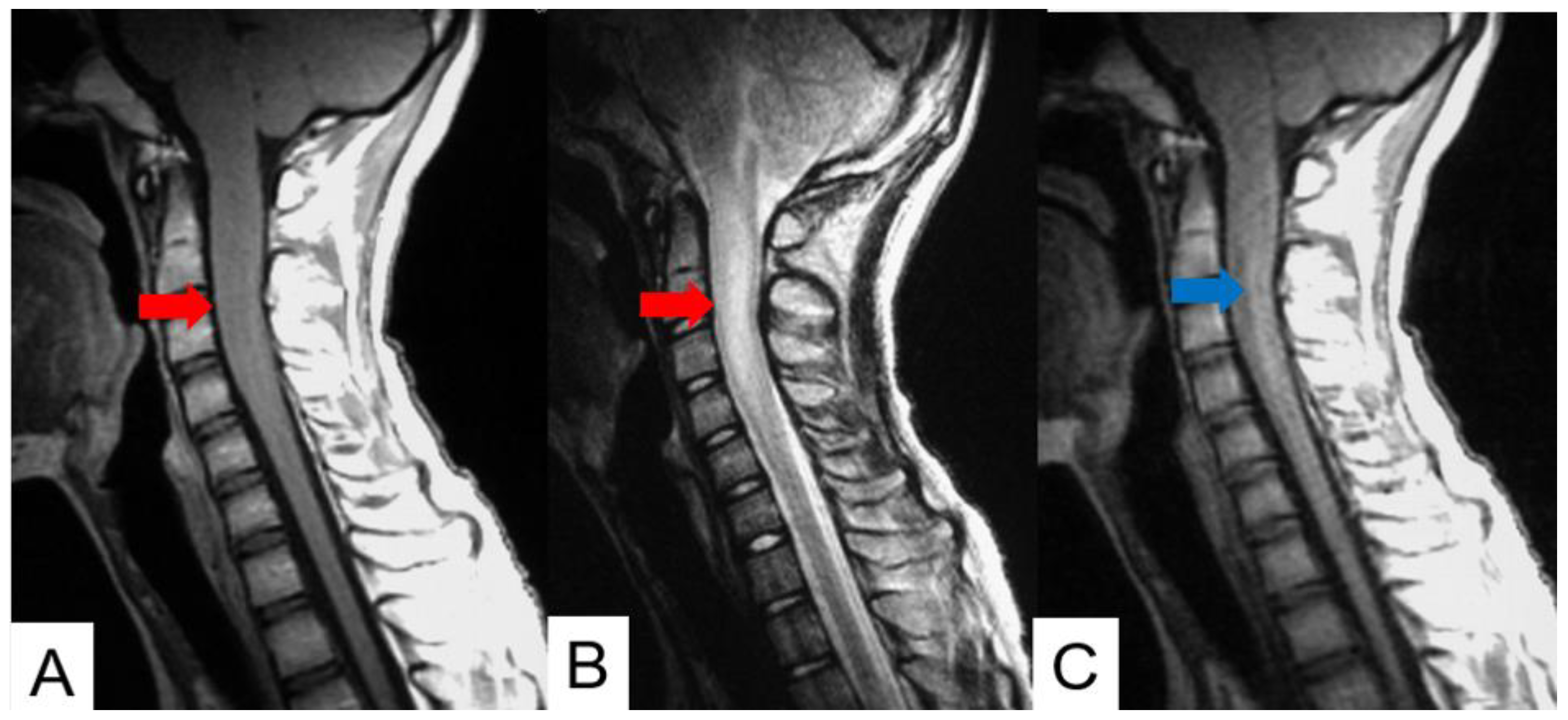 Cancers 16 02360 g005