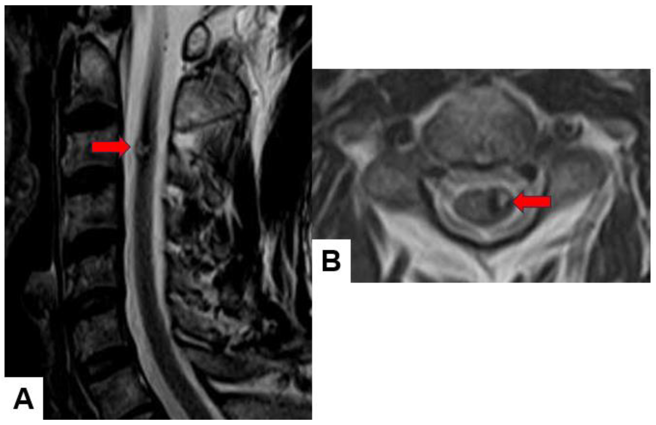 Cancers 16 02360 g008