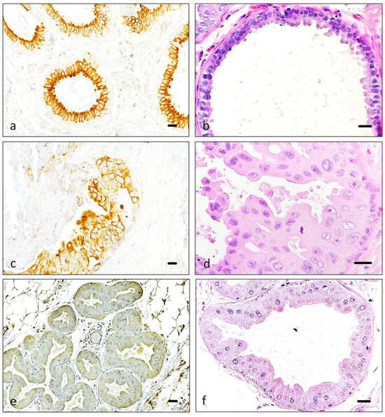 Cancers | Free Full-Text | Prognostic Evaluation of Piezo2 Channels in ...