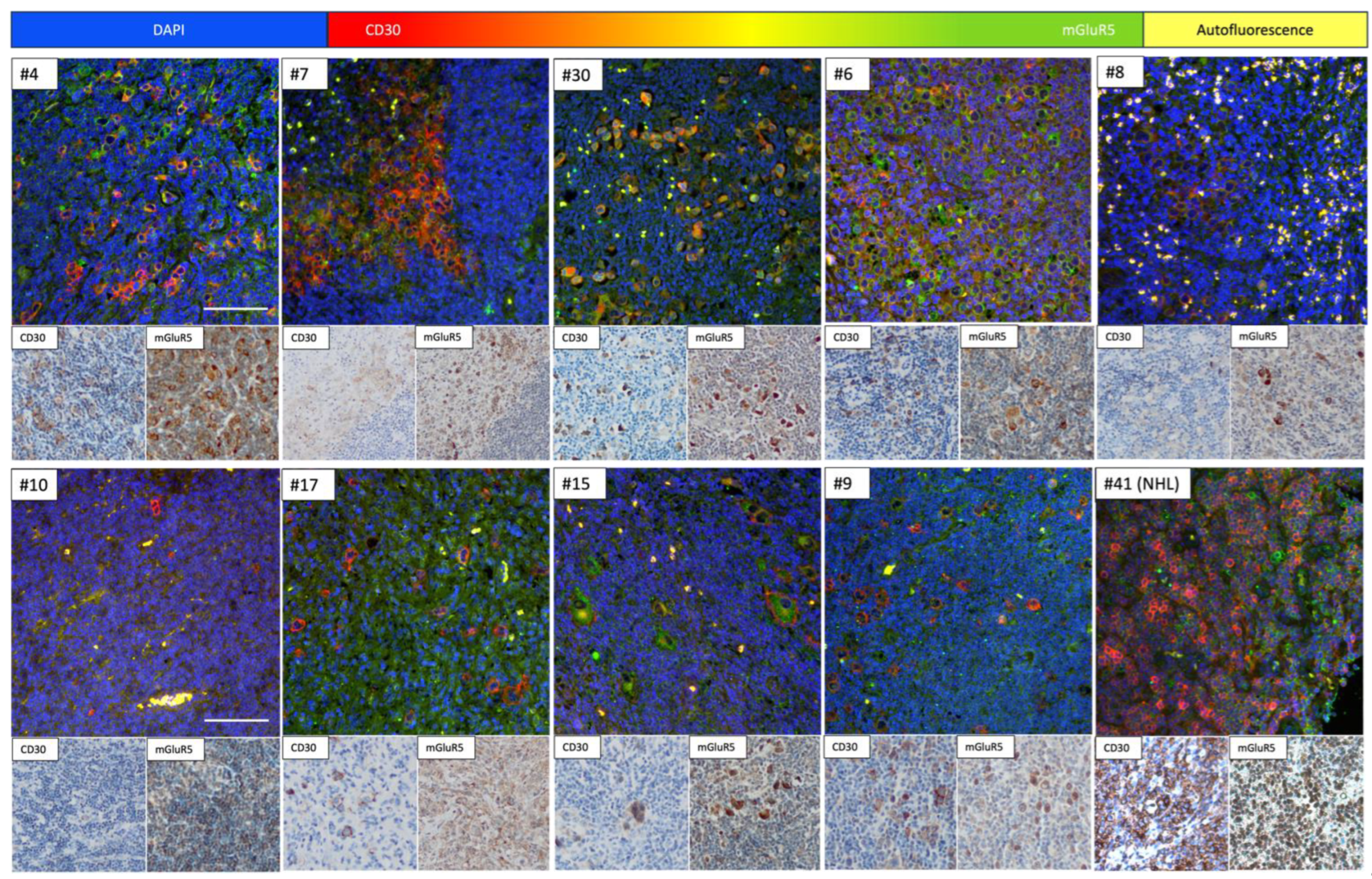 Cancers 16 02452 g002