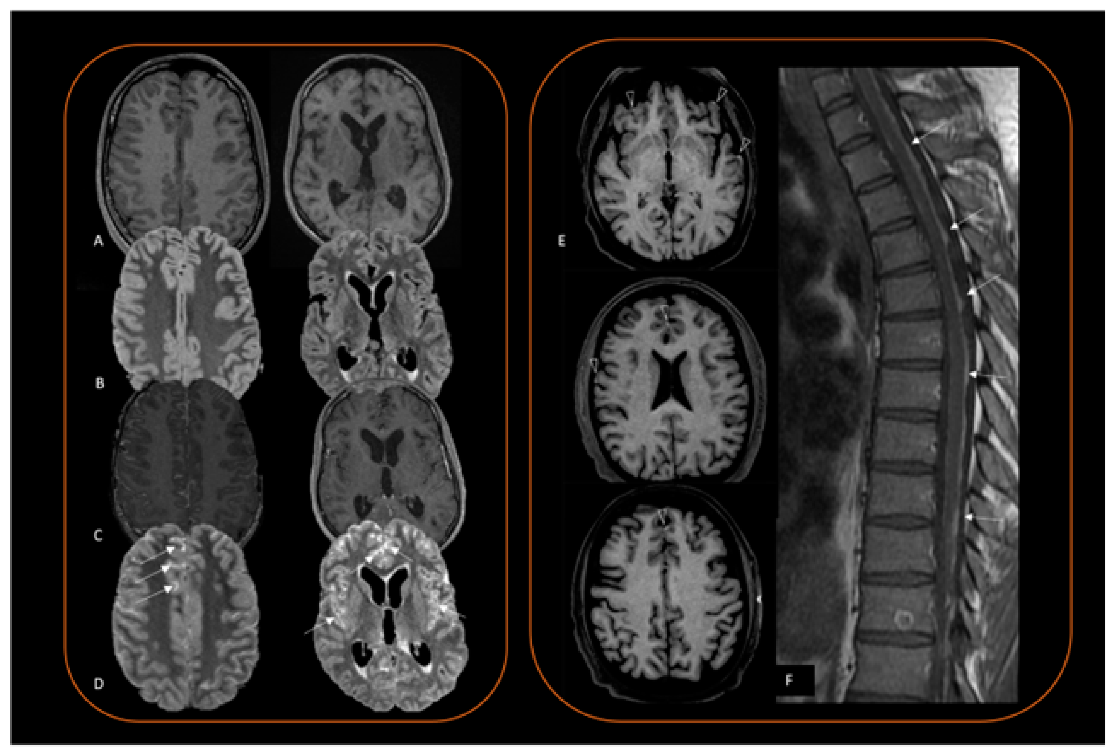 Cancers 16 02508 g003