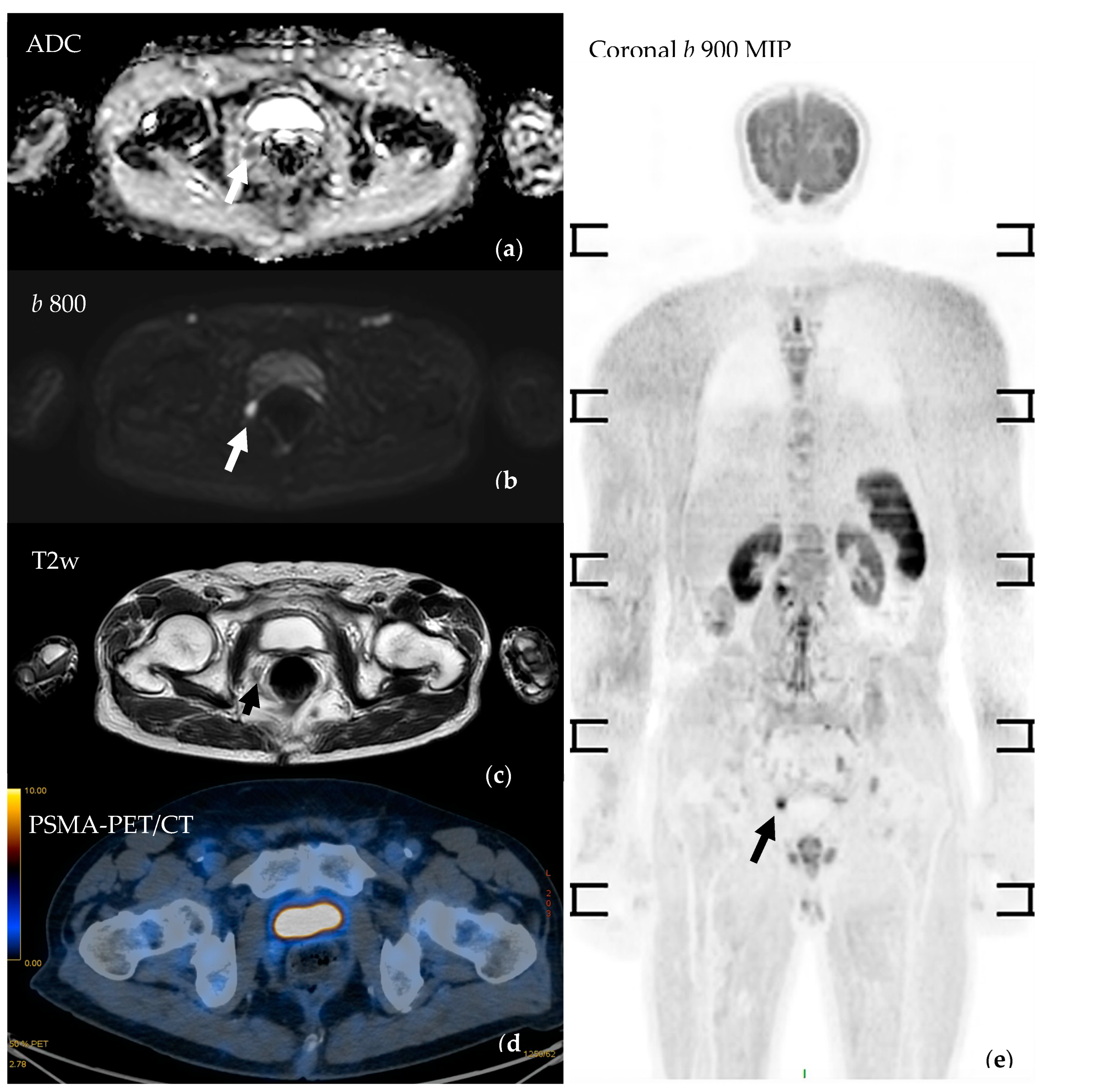 Cancers 16 02531 g004 Cancers 16 02531 g004