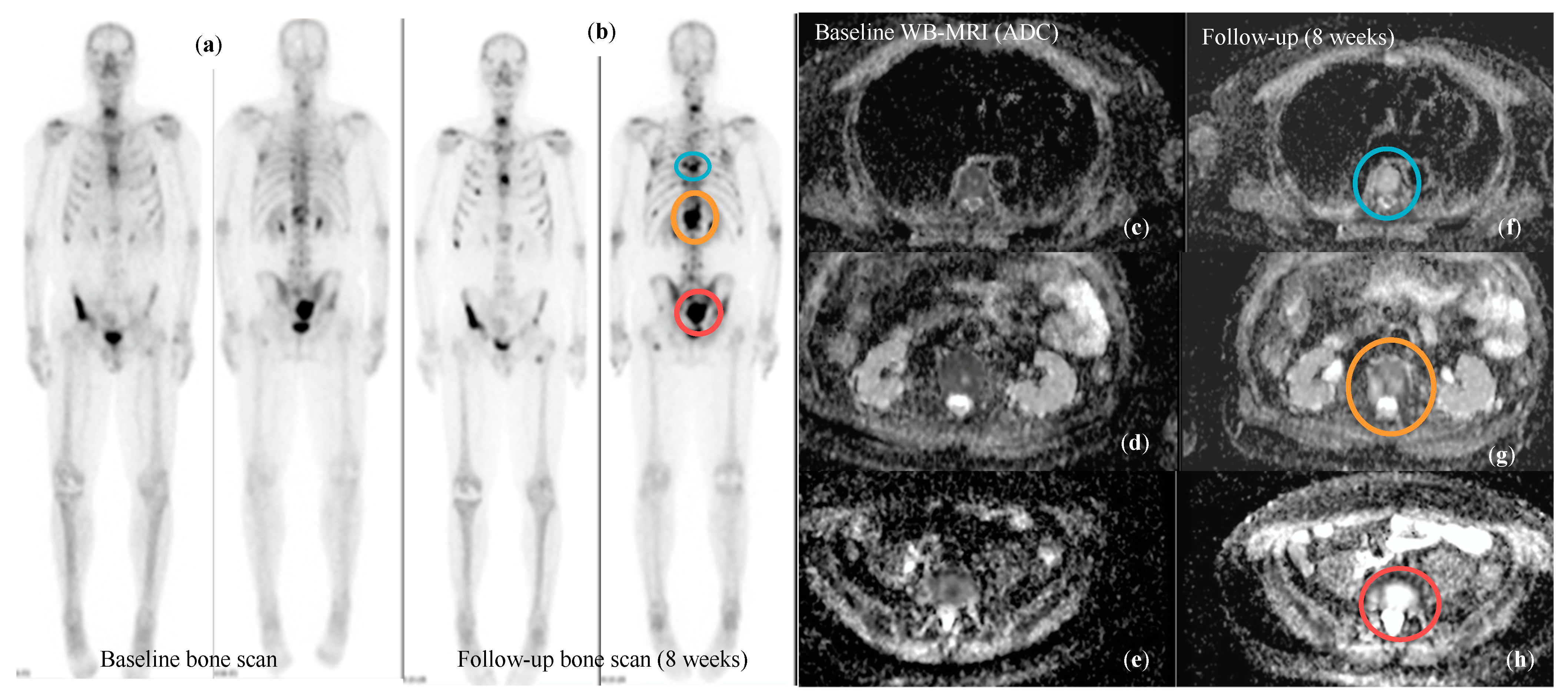 Cancers 16 02531 g005 Cancers 16 02531 g005