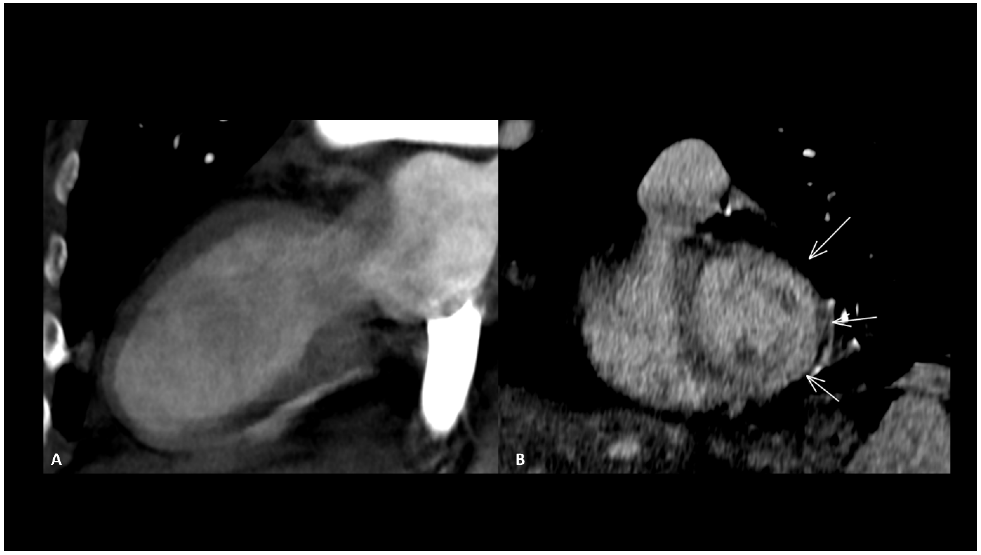 Cancers 16 02585 g005